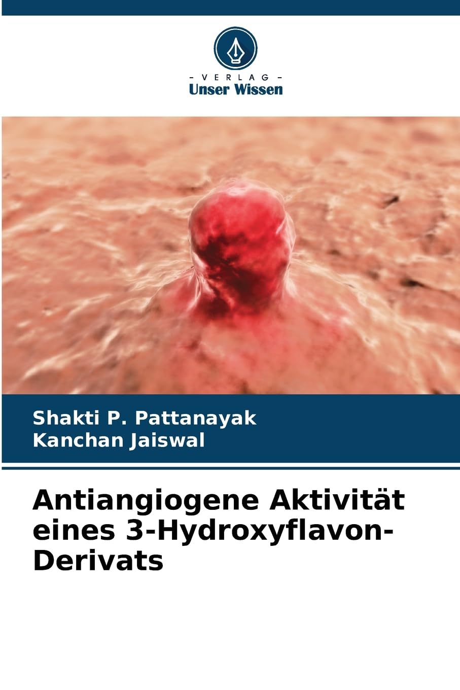 Antiangiogene Aktivität eines 3-Hydroxyflavon-Derivats Medicine
