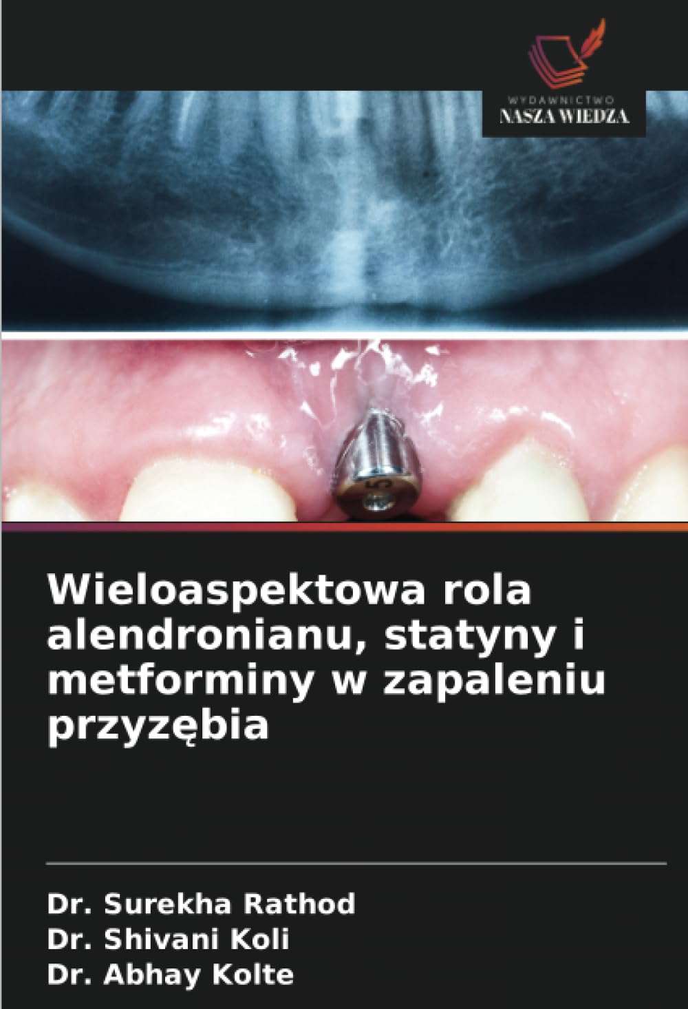 Wieloaspektowa rola alendronianu, statyny i metforminy w zapaleniu przyz¿bia Medicine
