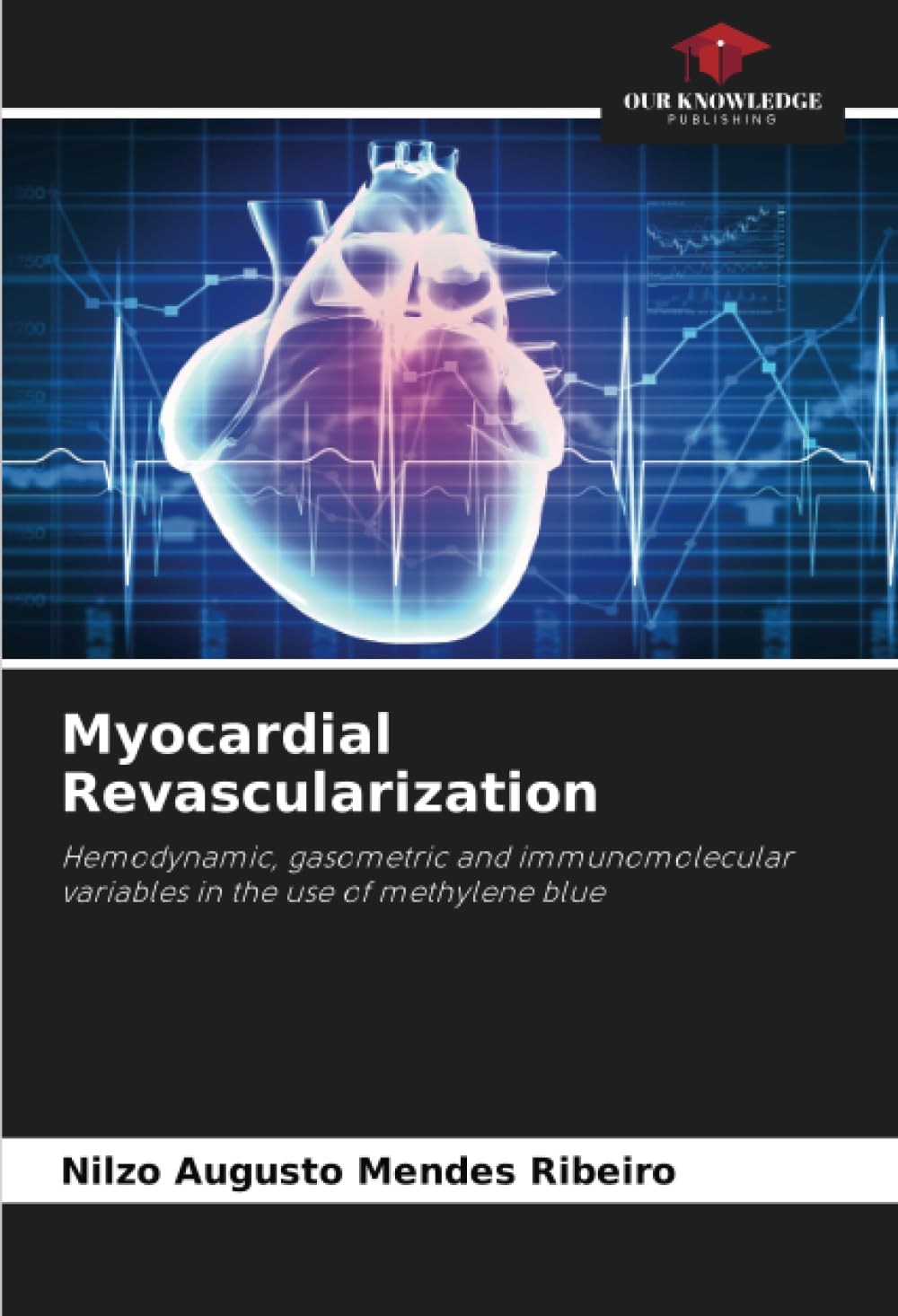 Myocardial Revascularization Medicine Books