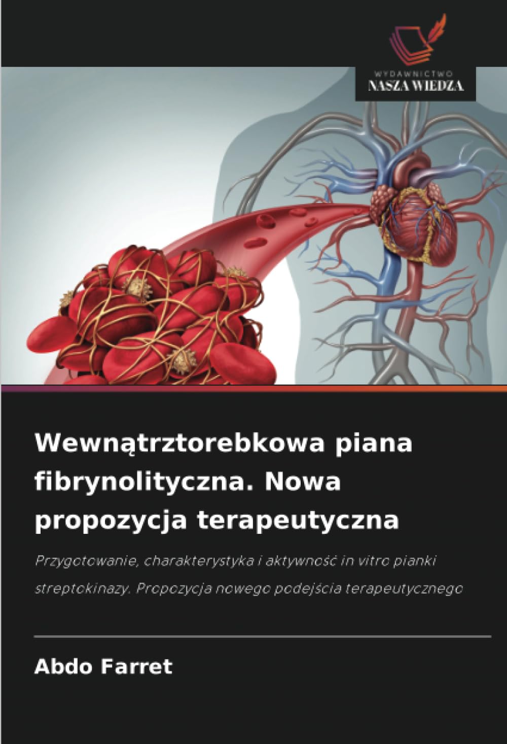 Wewn¿trztorebkowa piana fibrynolityczna. Nowa propozycja terapeutyczna Medicine