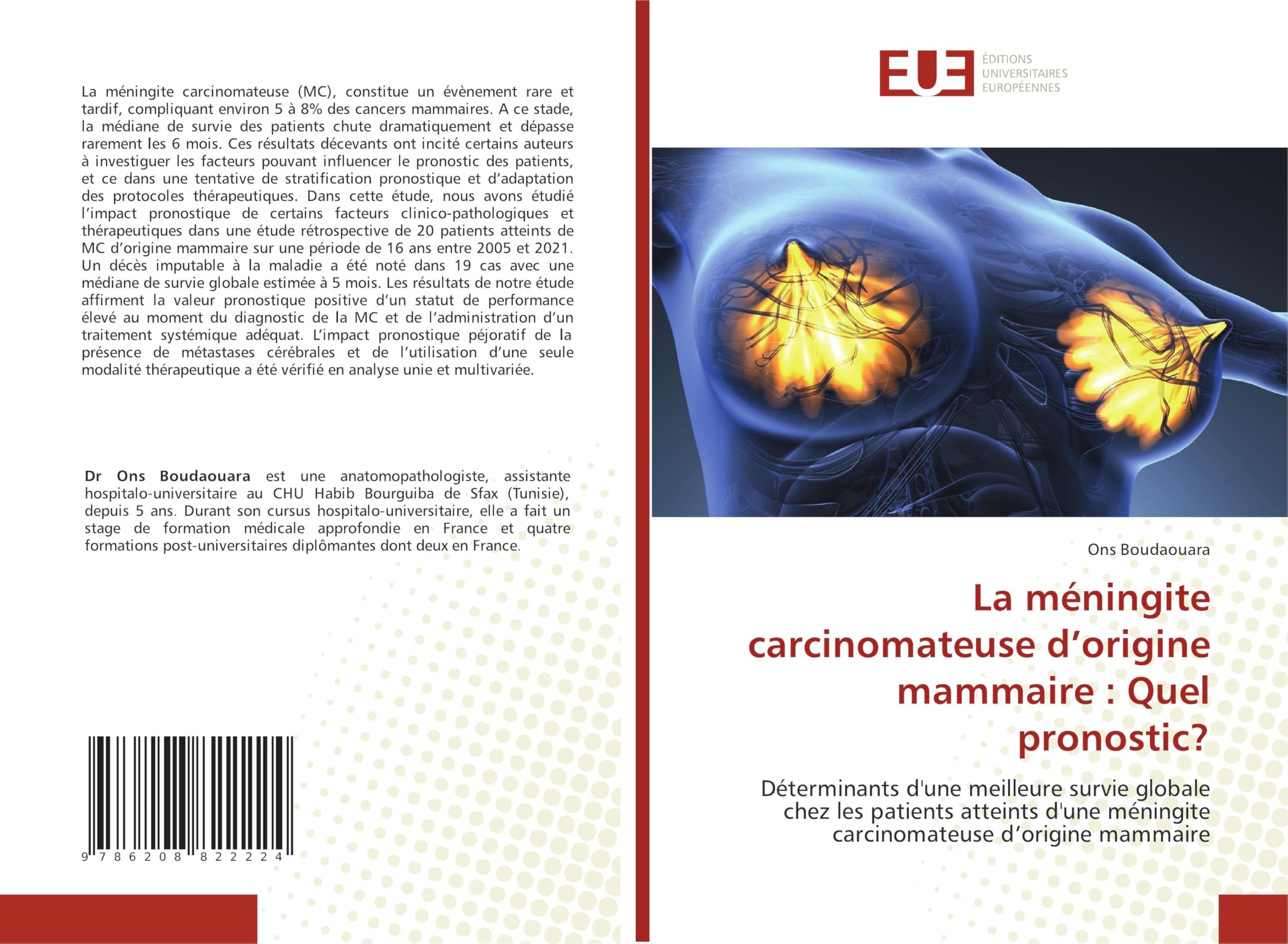La méningite carcinomateuse d'origine mammaire : Quel pronostic? Medicine