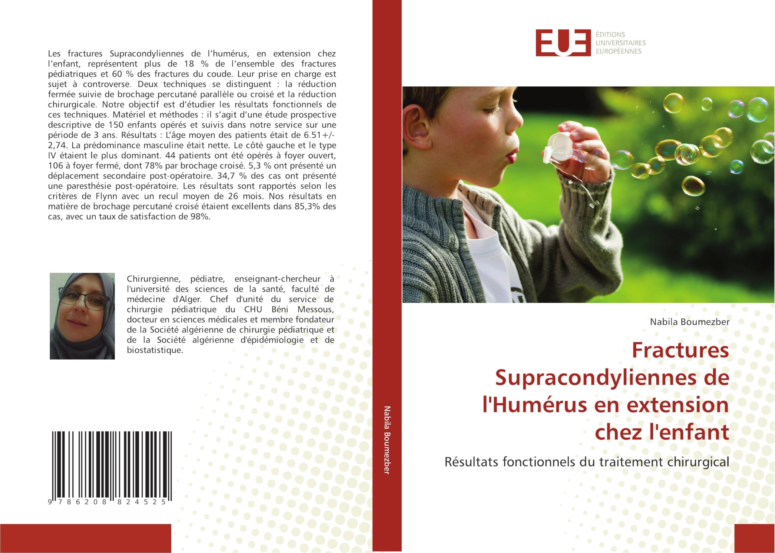 Fractures Supracondyliennes de l'Humérus en extension chez l'enfant Medicine