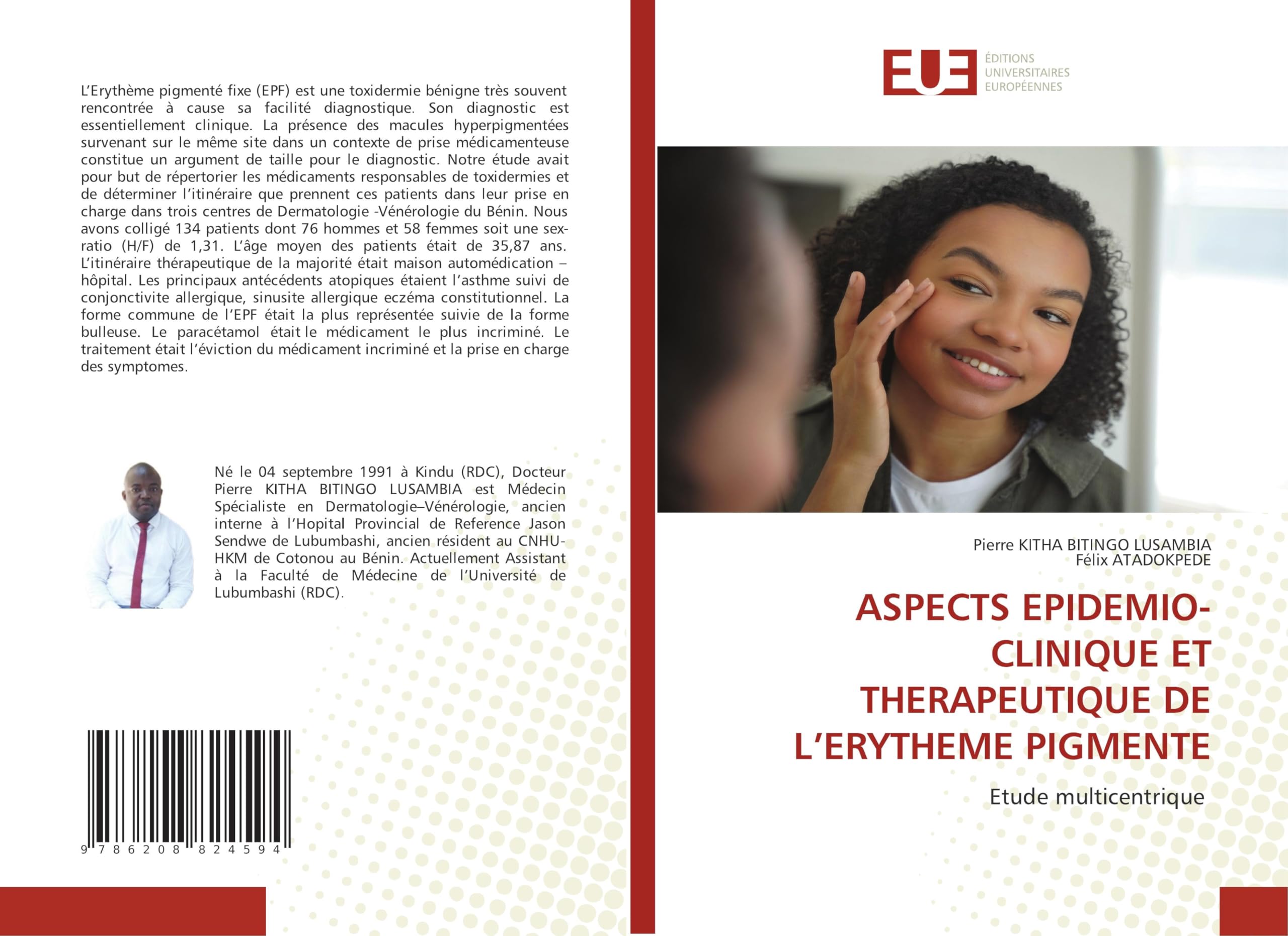 ASPECTS EPIDEMIO-CLINIQUE ET THERAPEUTIQUE DE L'ERYTHEME PIGMENTE Medicine