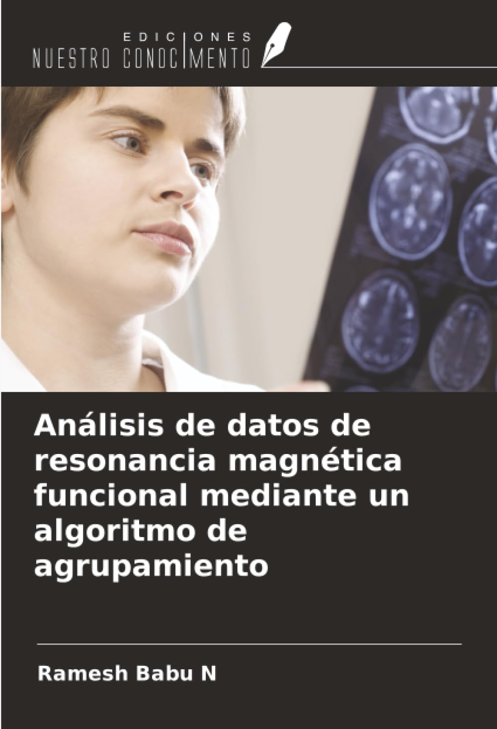 Análisis de datos de resonancia magnética funcional mediante un algoritmo de agrupamiento Business & Technology