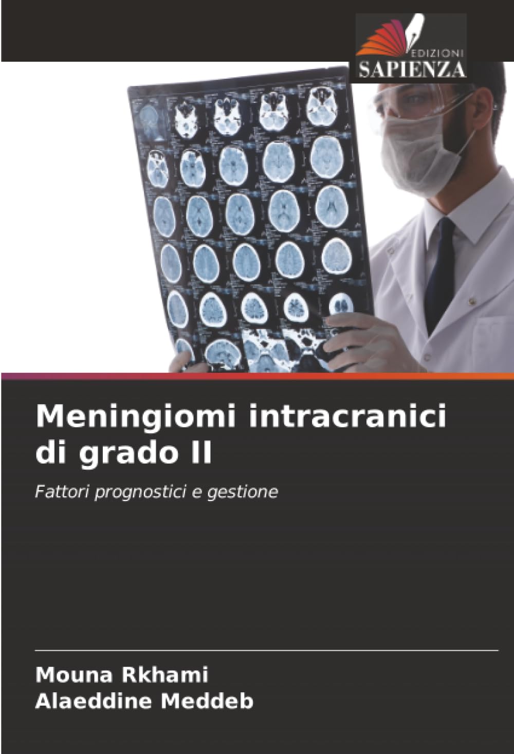 Meningiomi intracranici di grado II Medicine