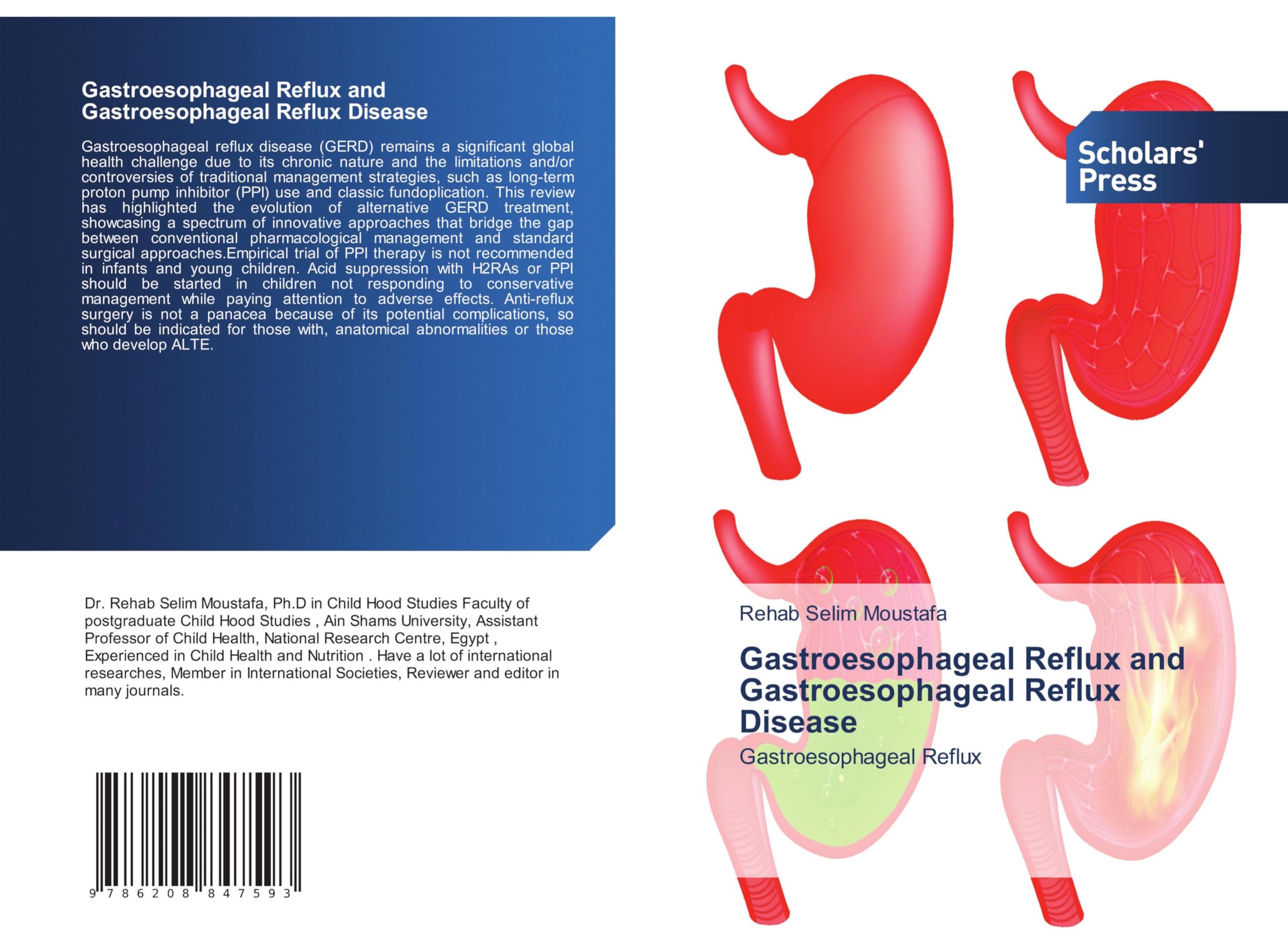 Gastroesophageal Reflux and Gastroesophageal Reflux Disease Law