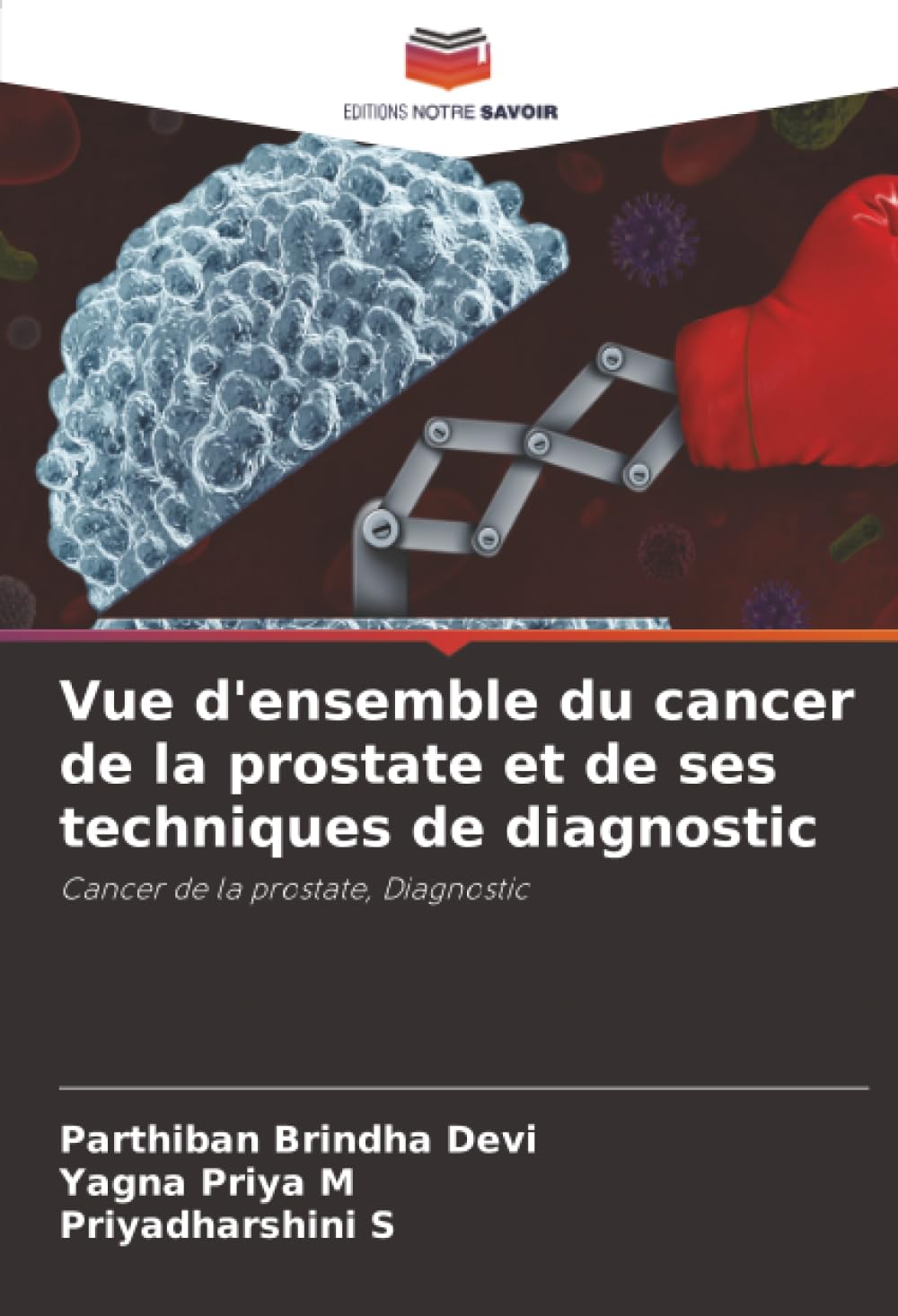 Product Image: Vue d'ensemble du cancer de la prostate et de ses techniques de diagnostic