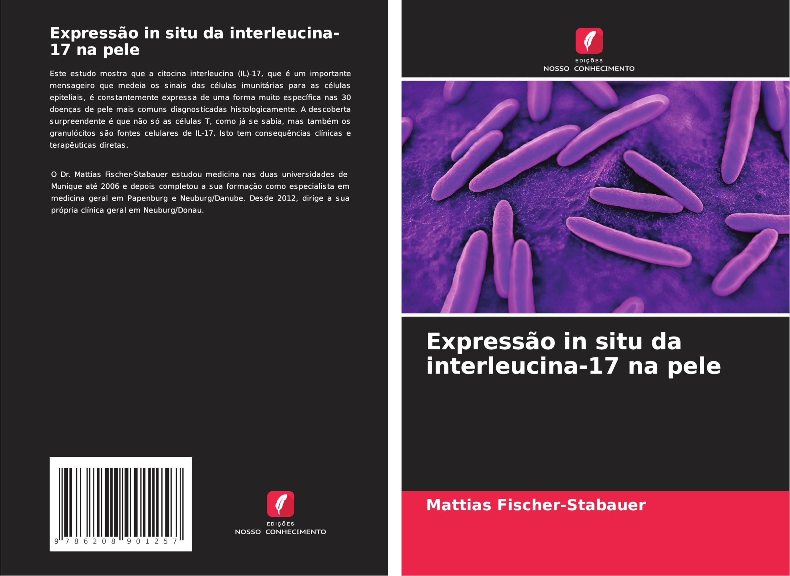 Expressão in situ da interleucina-17 na pele Medicine