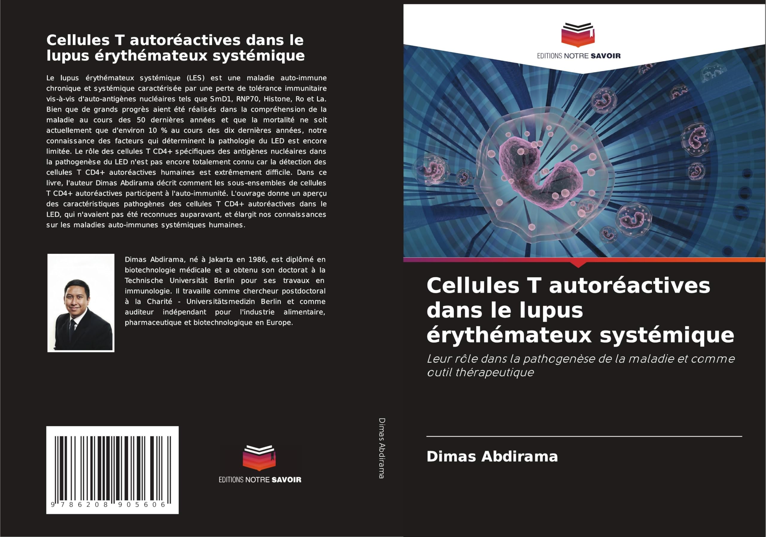 Cellules T autoréactives dans le lupus érythémateux systémique: Leur rôle dans la pathogenèse de la maladie et comme outil thérapeutique Medicine