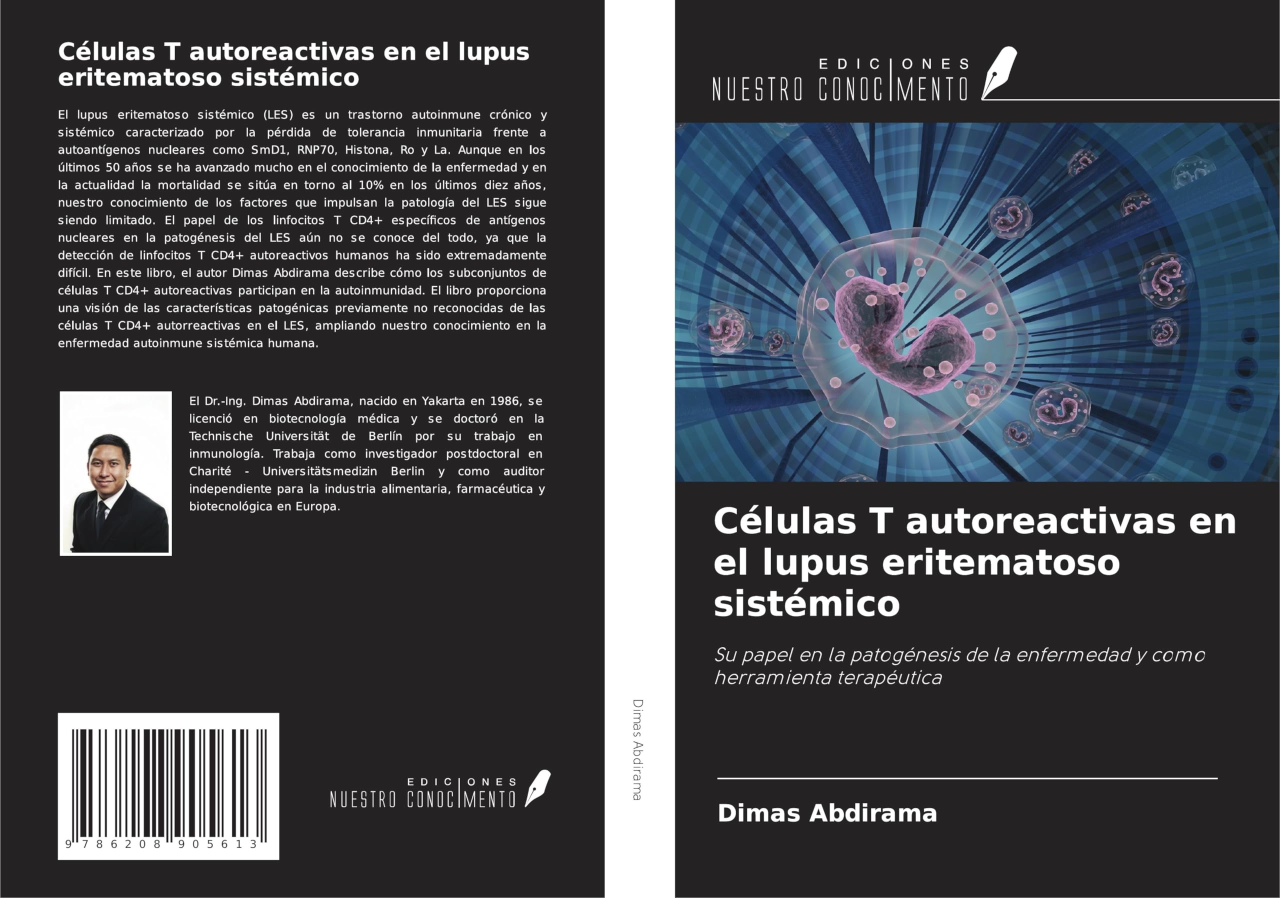 Células T autoreactivas en el lupus eritematoso sistémico: Su papel en la patogénesis de la enfermedad y como herramienta terapéutica Medicine