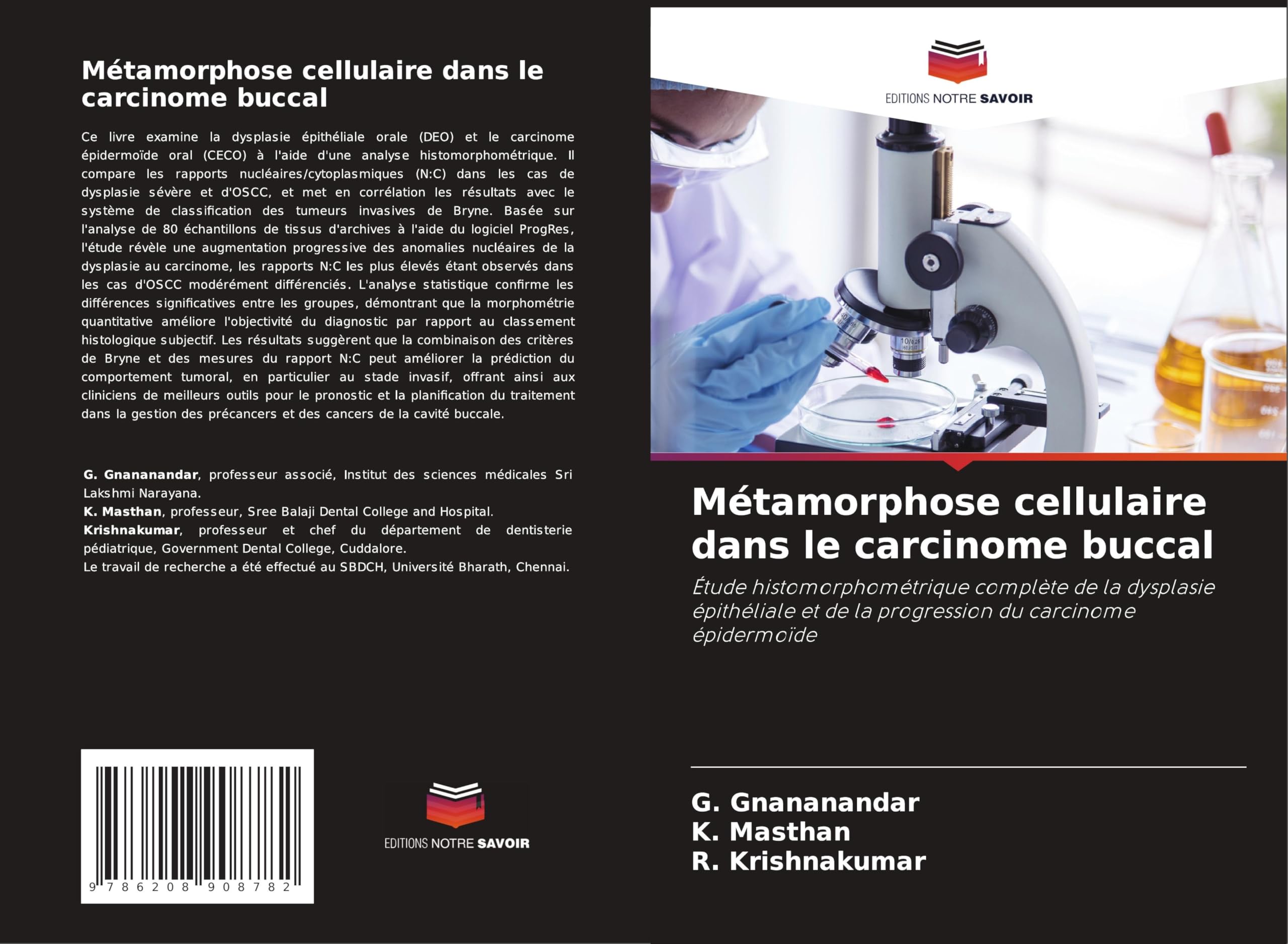 Métamorphose cellulaire dans le carcinome buccal: Étude histomorphométrique complète de la dysplasie épithéliale et de la progression du carcinome épidermoïde Medicine