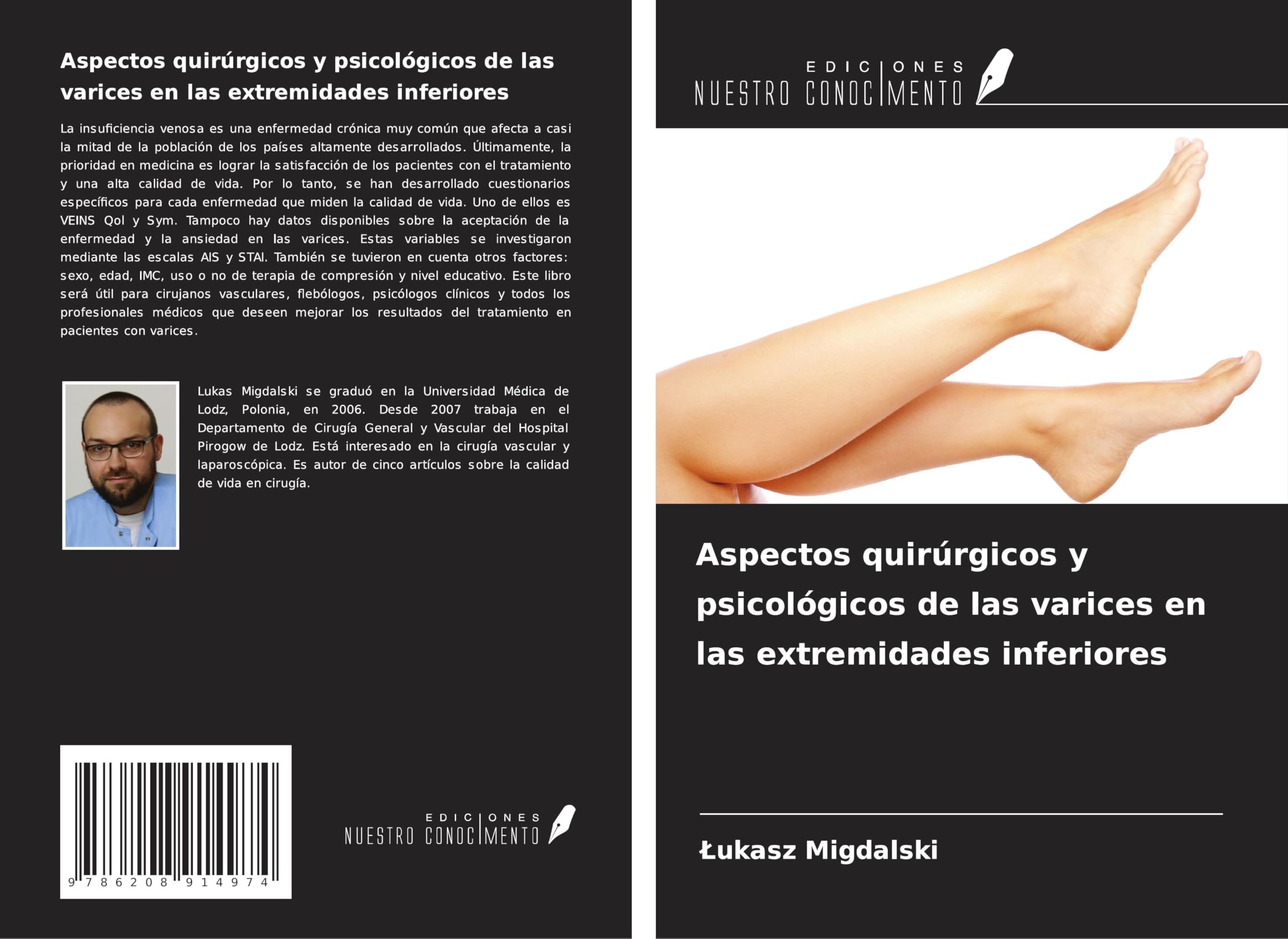 Aspectos quirúrgicos y psicológicos de las varices en las extremidades inferiores Medicine