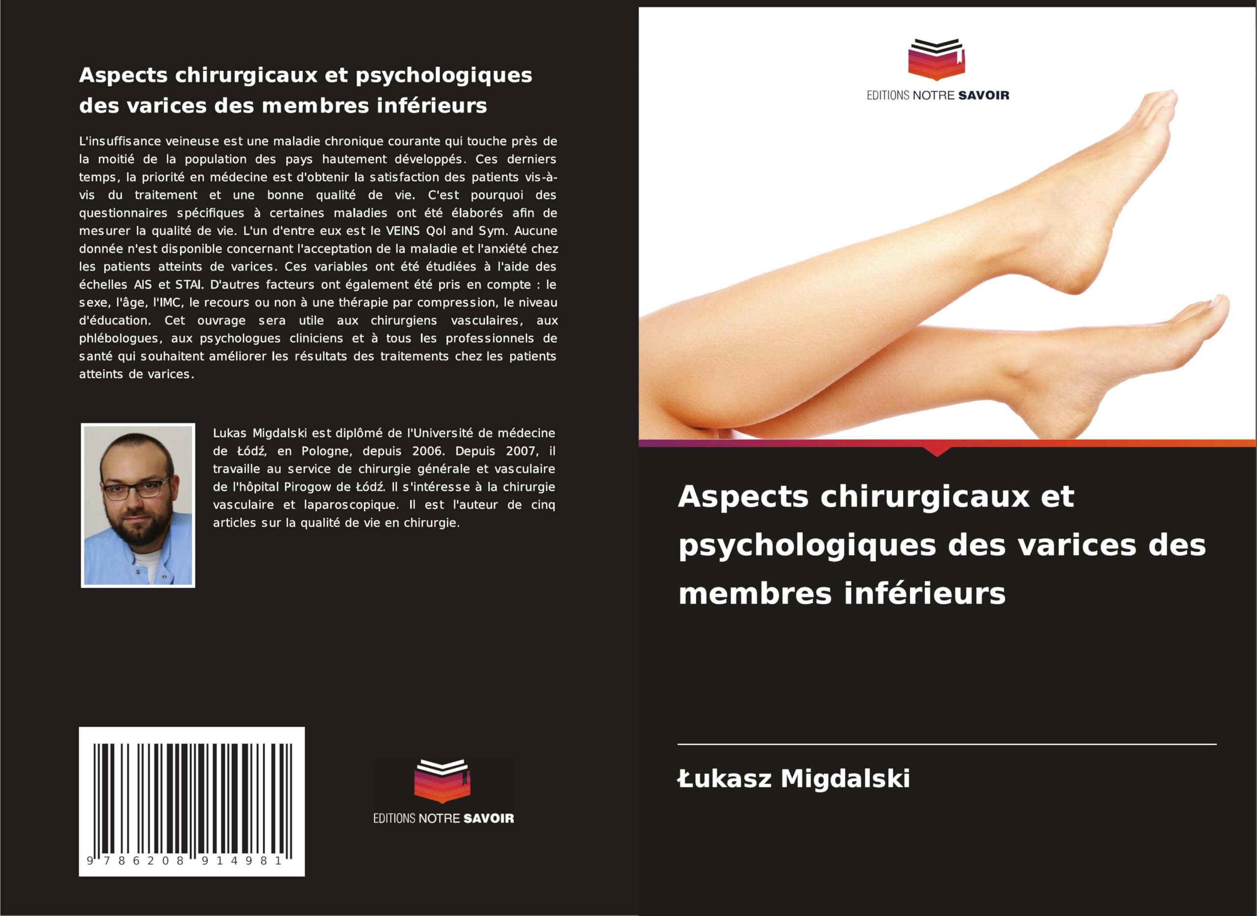 Aspects chirurgicaux et psychologiques des varices des membres inférieurs Medicine