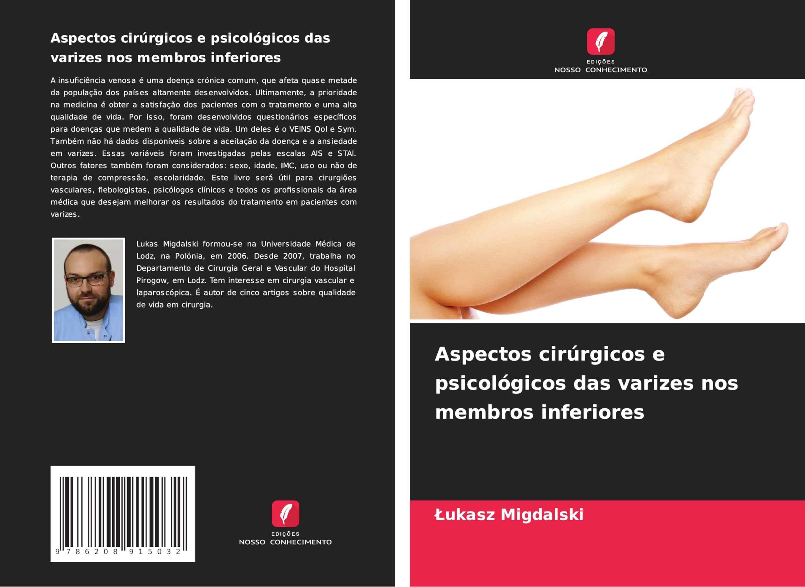 Aspectos cirúrgicos e psicológicos das varizes nos membros inferiores Medicine