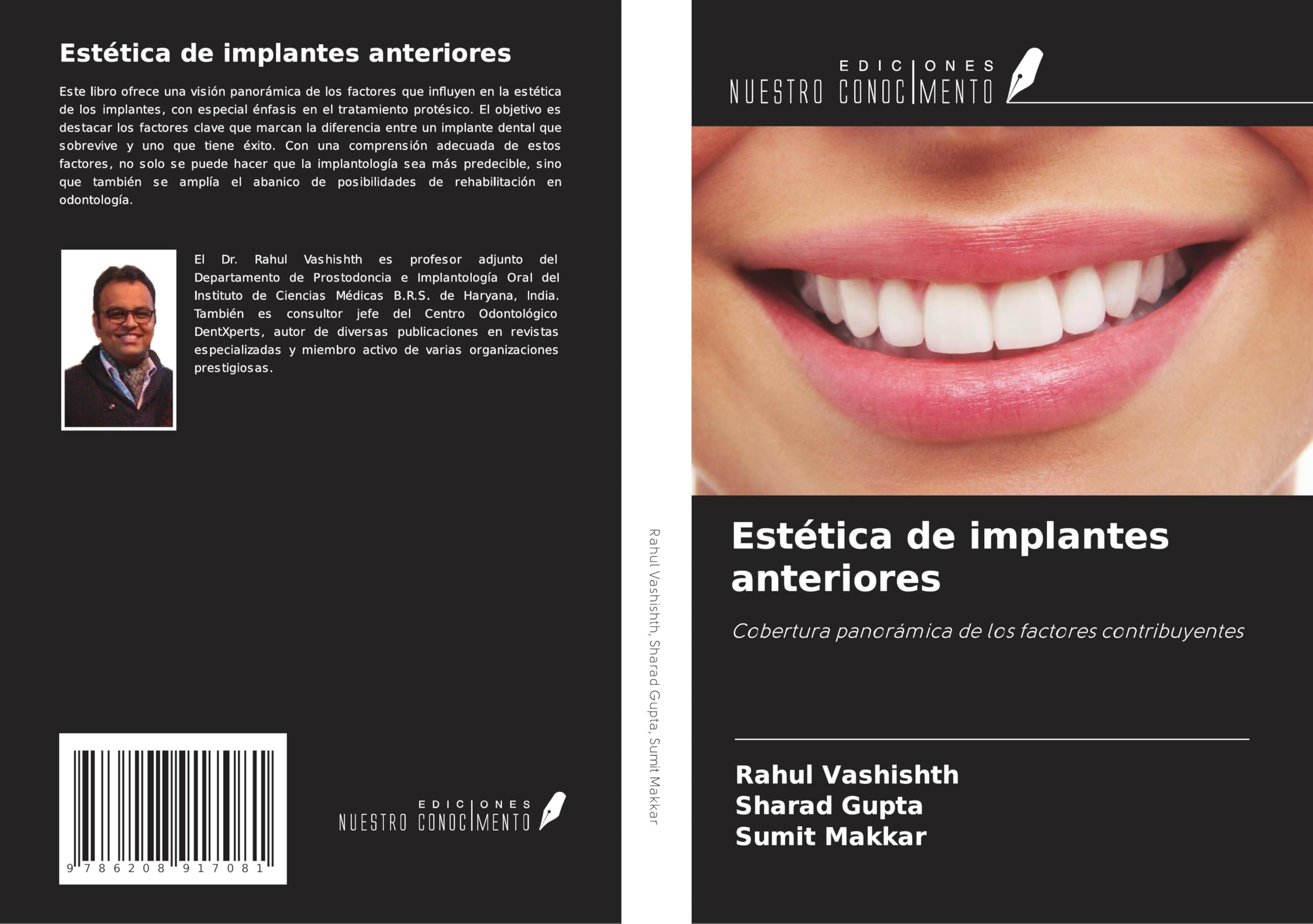 Estética de implantes anteriores Medicine