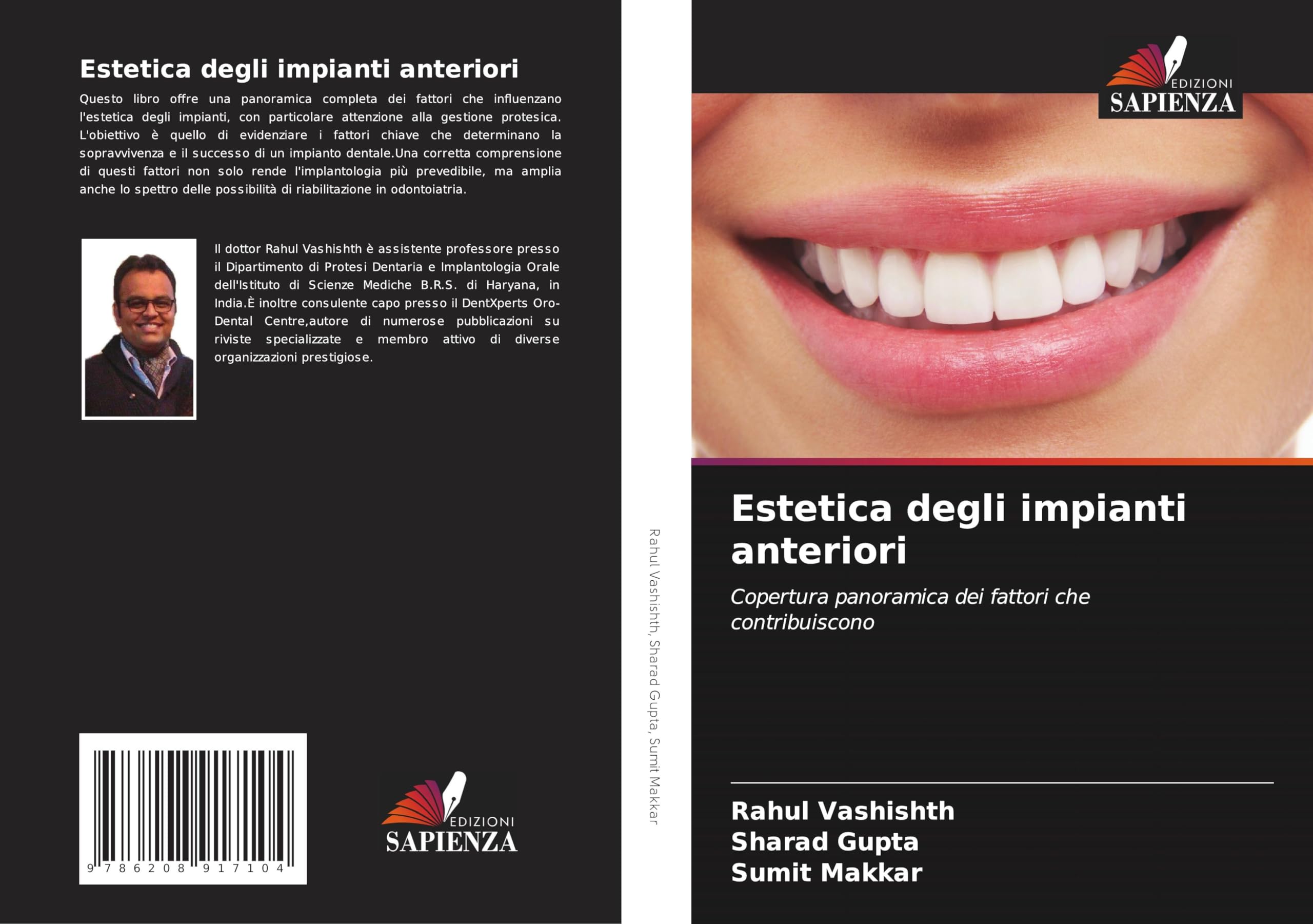 Estetica degli impianti anteriori Medicine