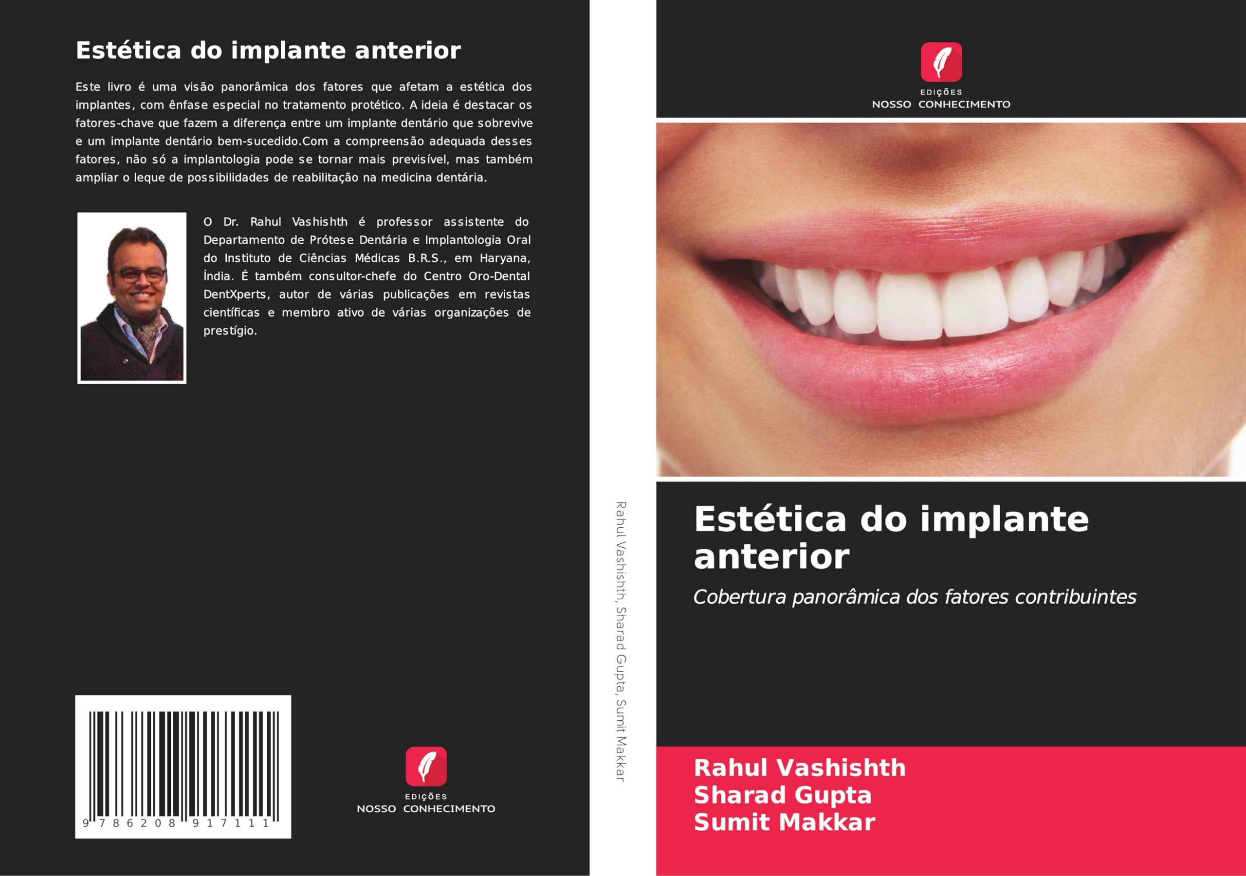 Estética do implante anterior: Cobertura panorâmica dos fatores contribuintes Medicine