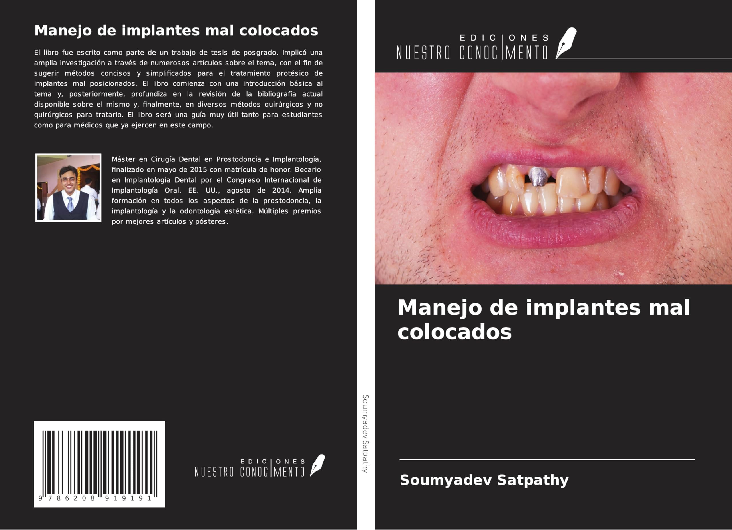 Manejo de implantes mal colocados Medicine