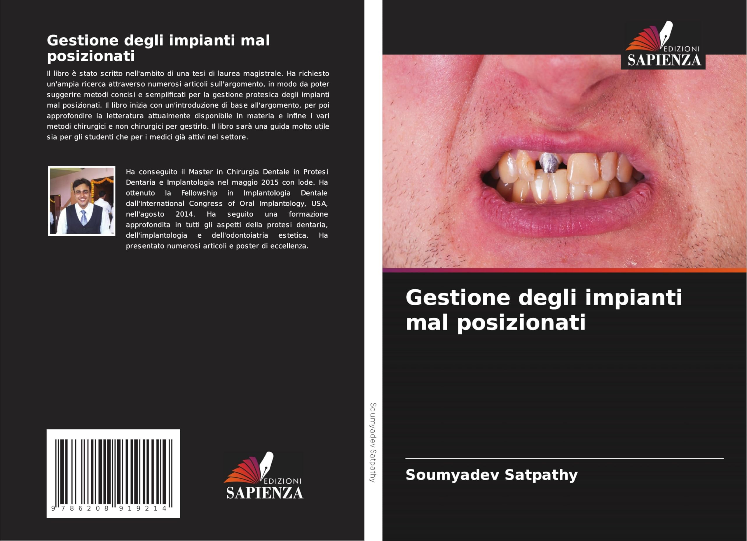 Gestione degli impianti mal posizionati Medicine