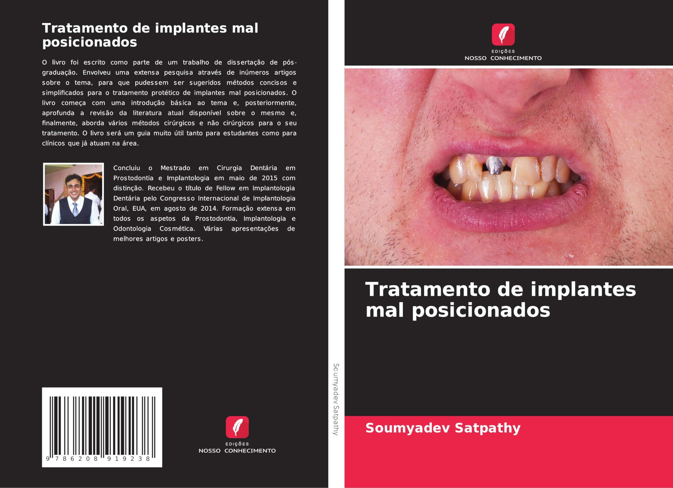 Tratamento de implantes mal posicionados Medicine