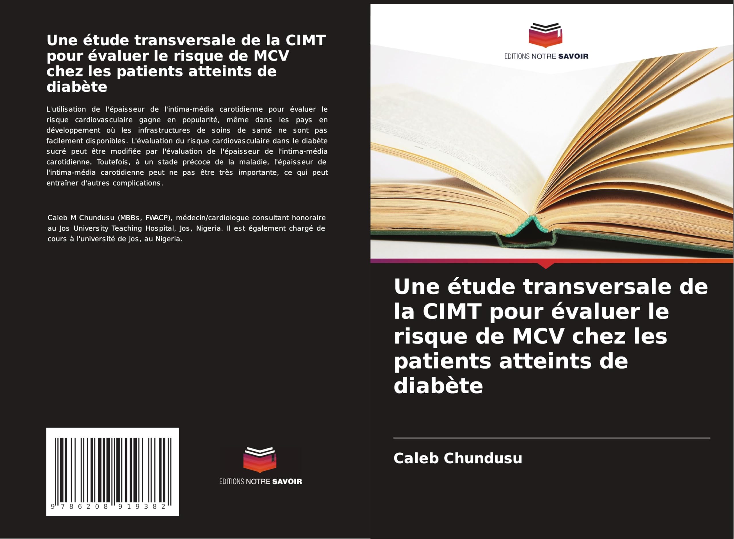 Une étude transversale de la CIMT pour évaluer le risque de MCV chez les patients atteints de diabète Medicine