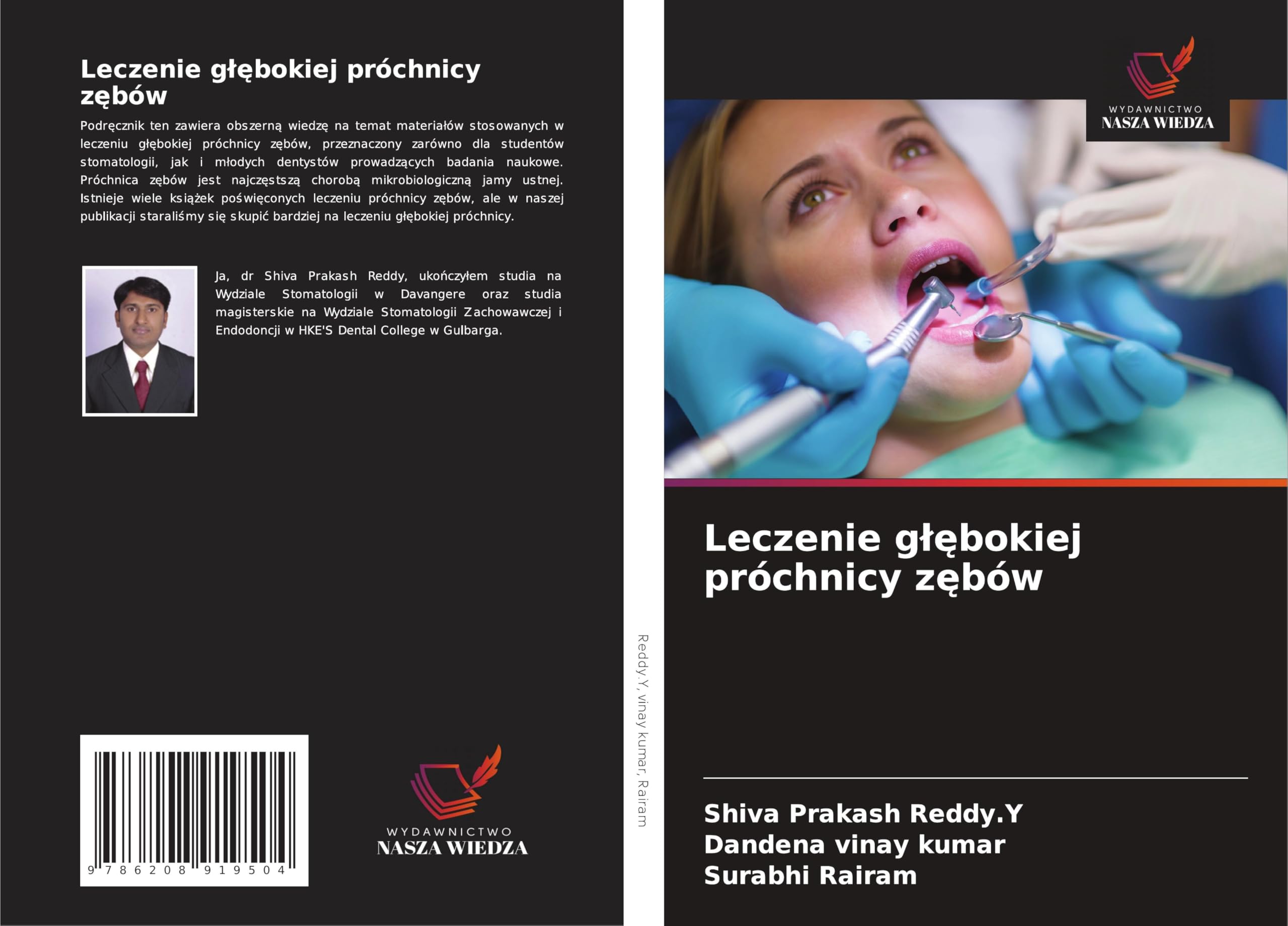 Leczenie g¿¿bokiej próchnicy z¿bów Medicine