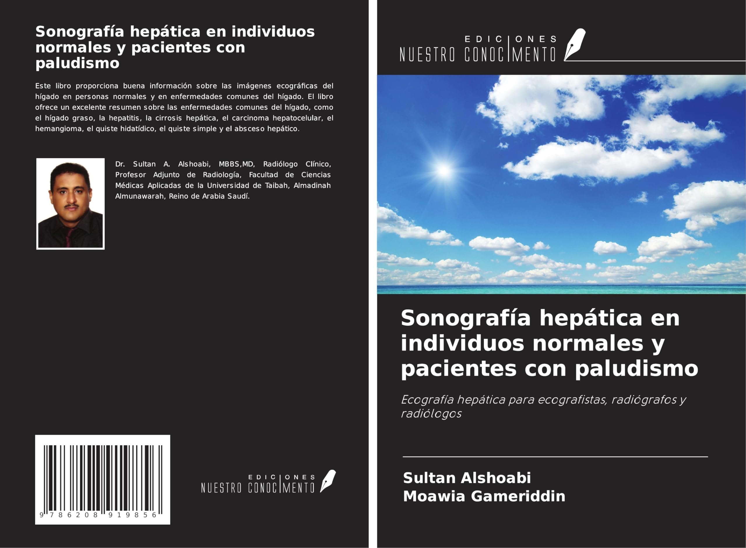 Sonografía hepática en individuos normales y pacientes con paludismo: Ecografía hepática para ecografistas, radiógrafos y radiólogos Medicine