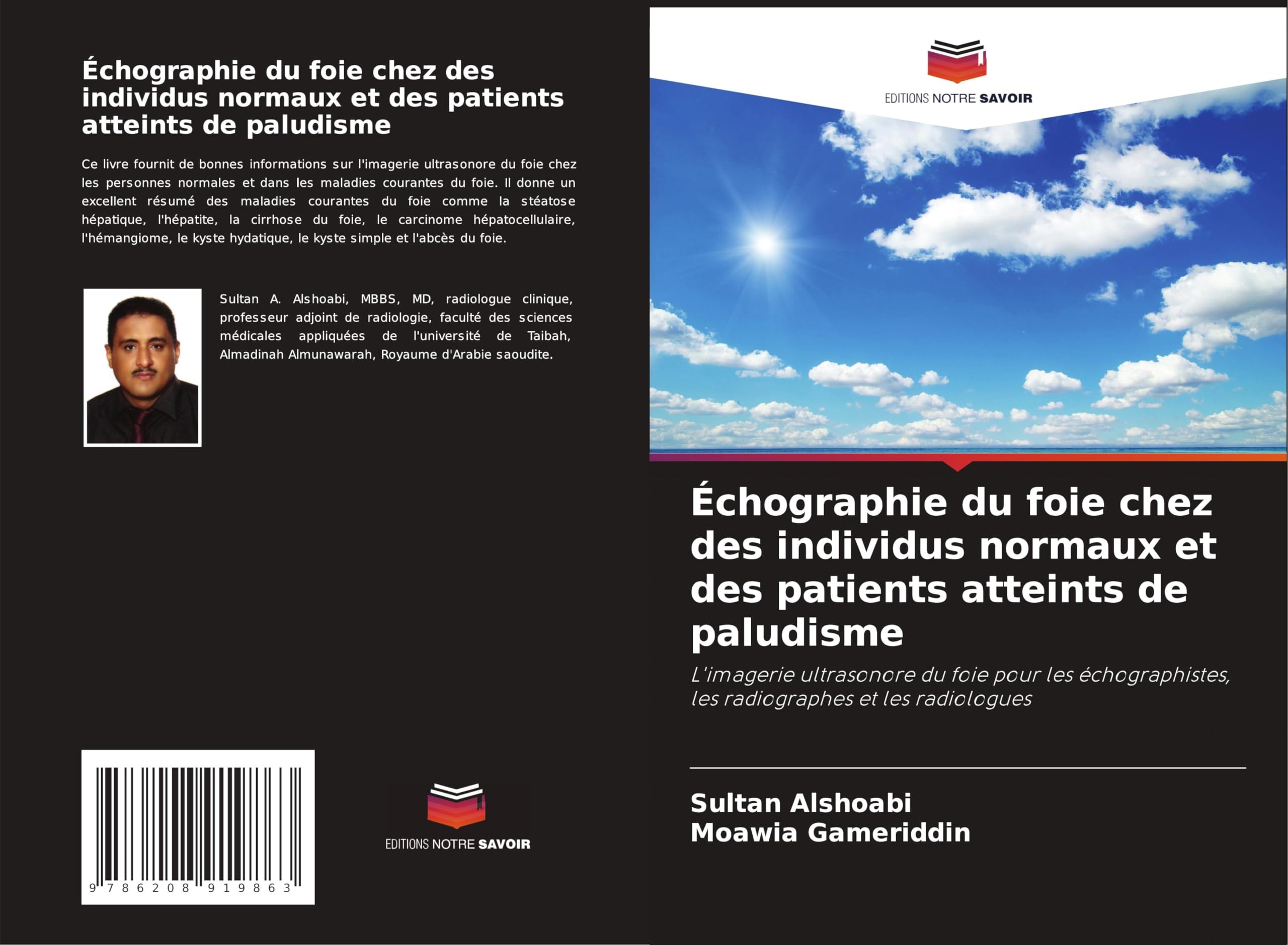 Échographie du foie chez des individus normaux et des patients atteints de paludisme Medicine