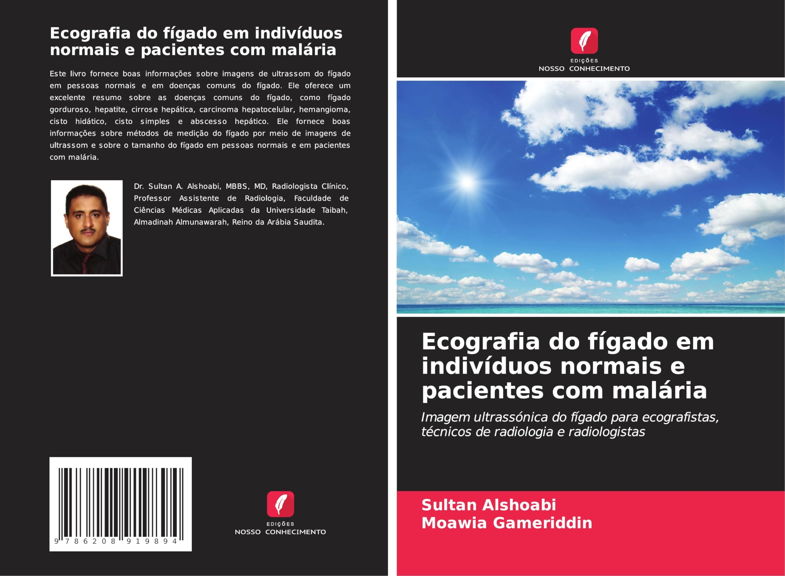Ecografia do fígado em indivíduos normais e pacientes com malária Medicine