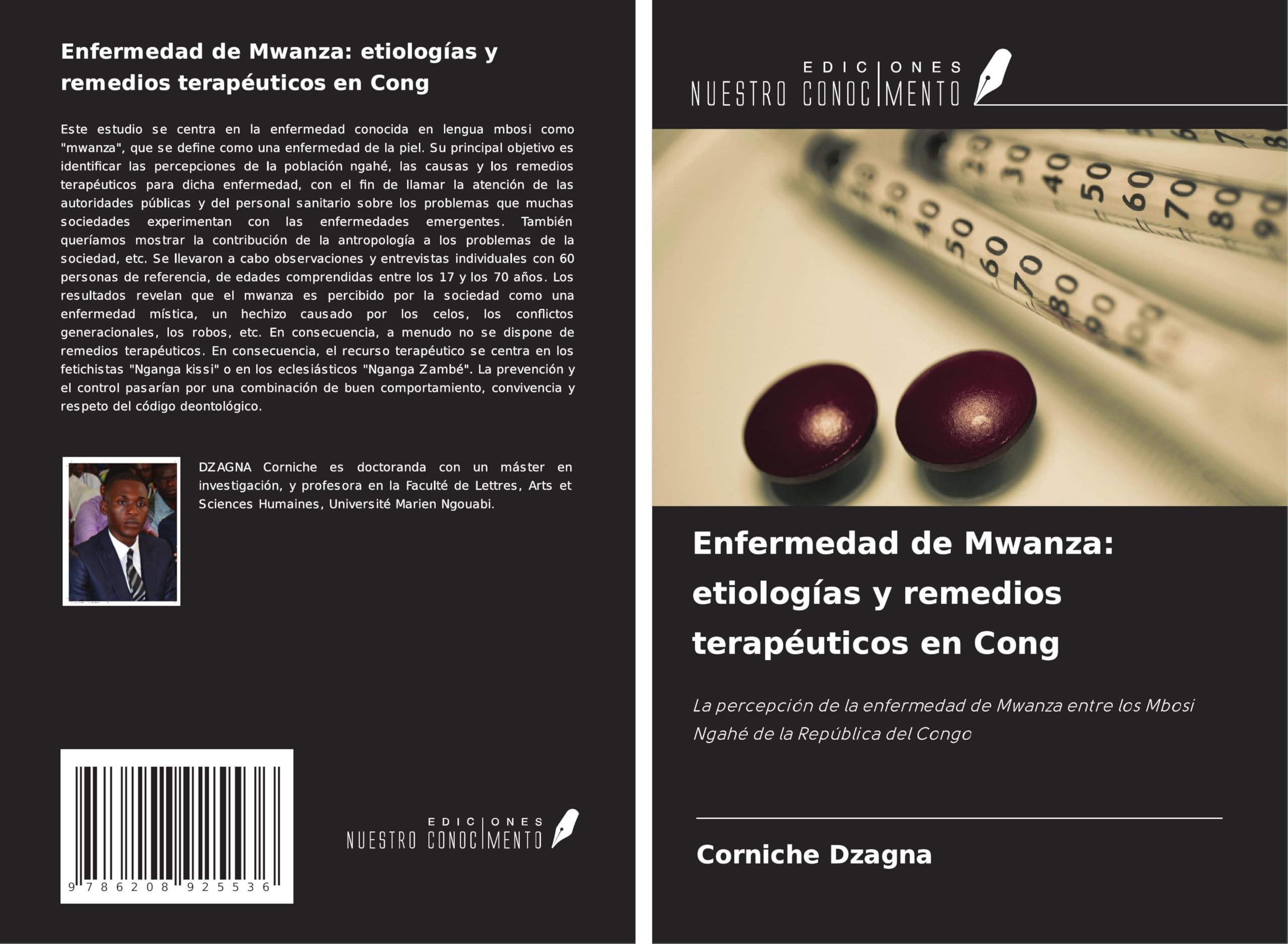 Enfermedad de Mwanza: etiologías y remedios terapéuticos en Cong: La percepción de la enfermedad de Mwanza entre los Mbosi Ngahé de la República del Congo Medicine