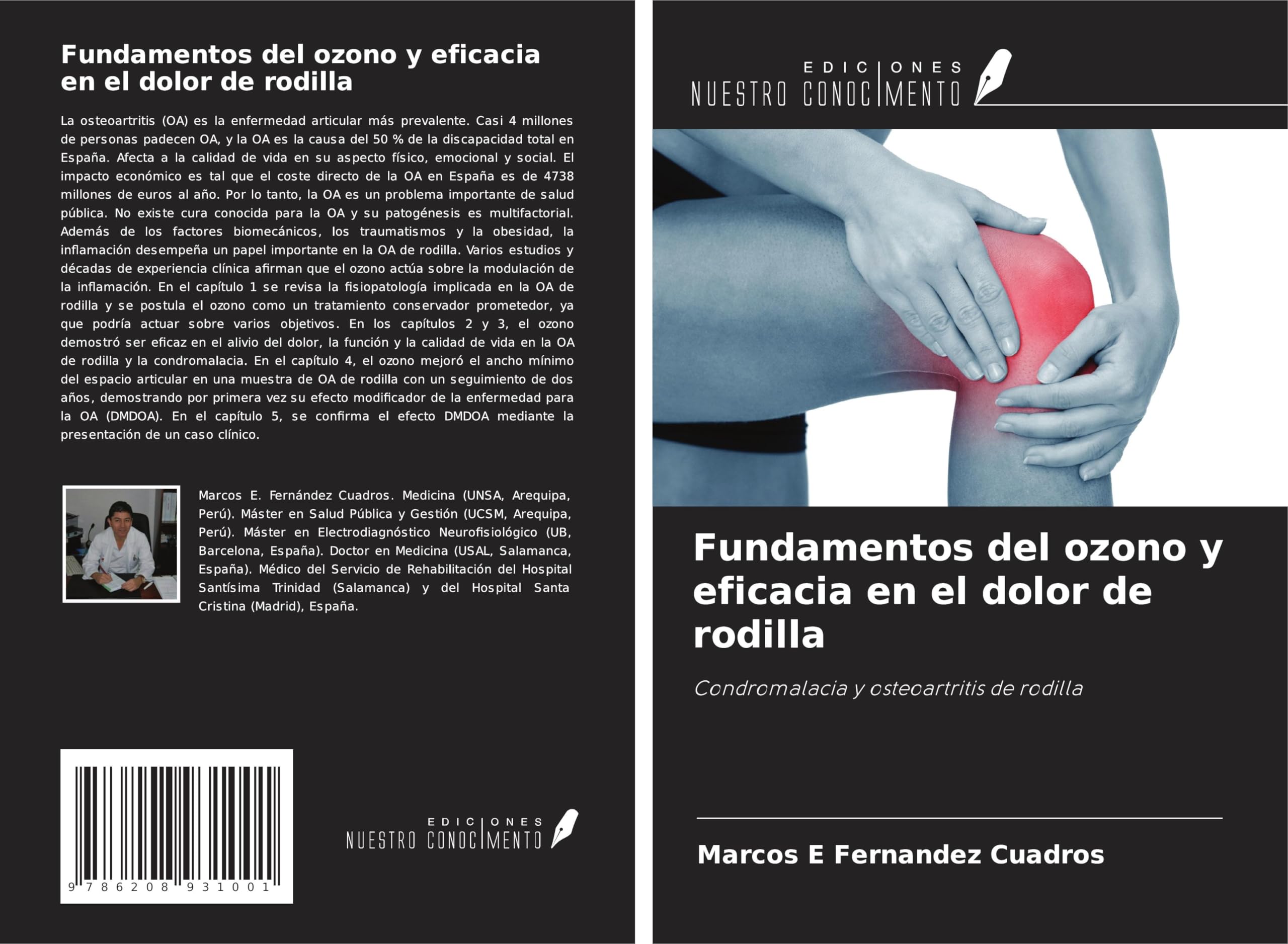 Fundamentos del ozono y eficacia en el dolor de rodilla Medicine