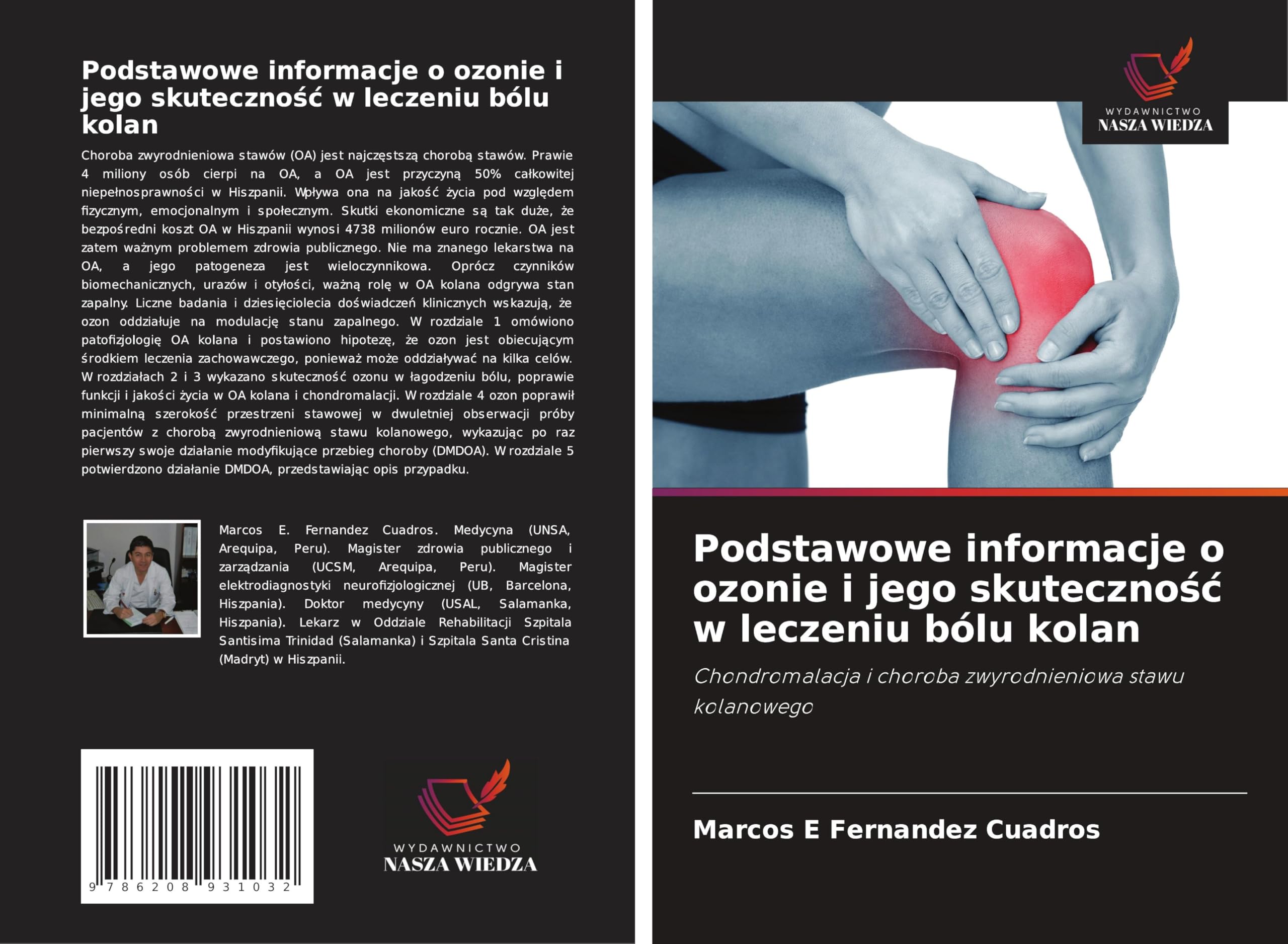 Podstawowe informacje o ozonie i jego skuteczno¿¿ w leczeniu bólu kolan Medicine