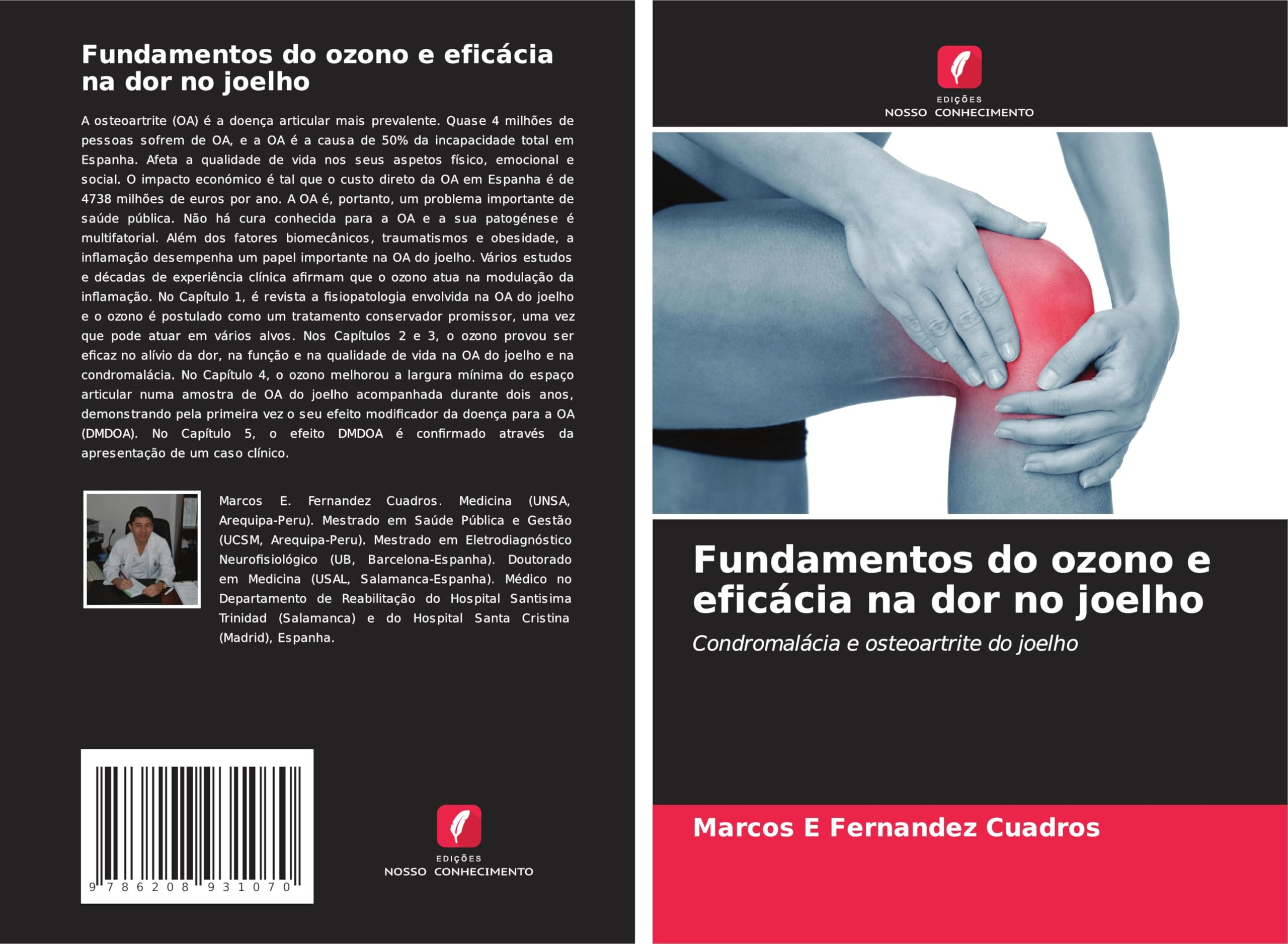 Fundamentos do ozono e eficácia na dor no joelho Medicine