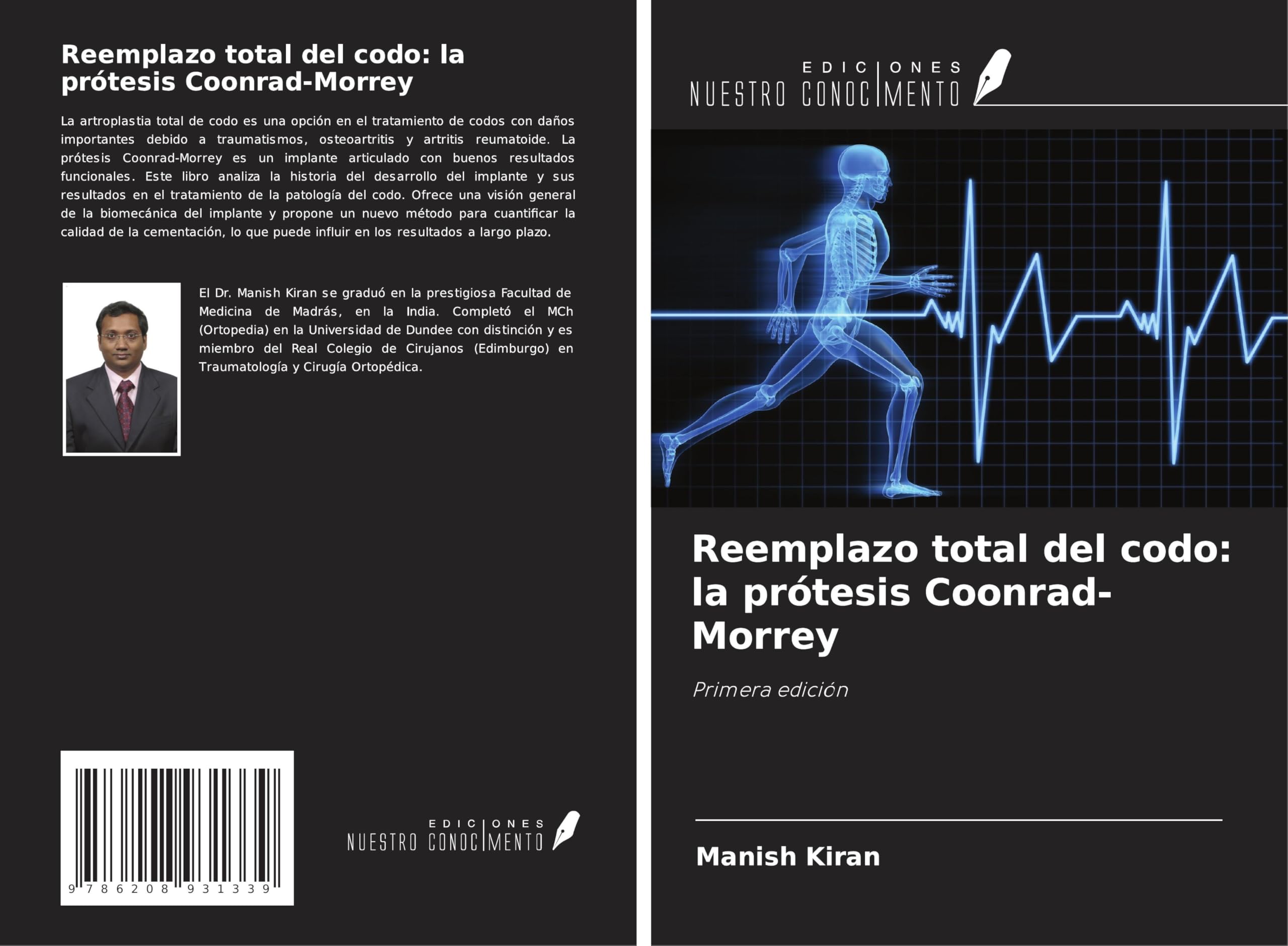 Reemplazo total del codo: la prótesis Coonrad-Morrey Medicine