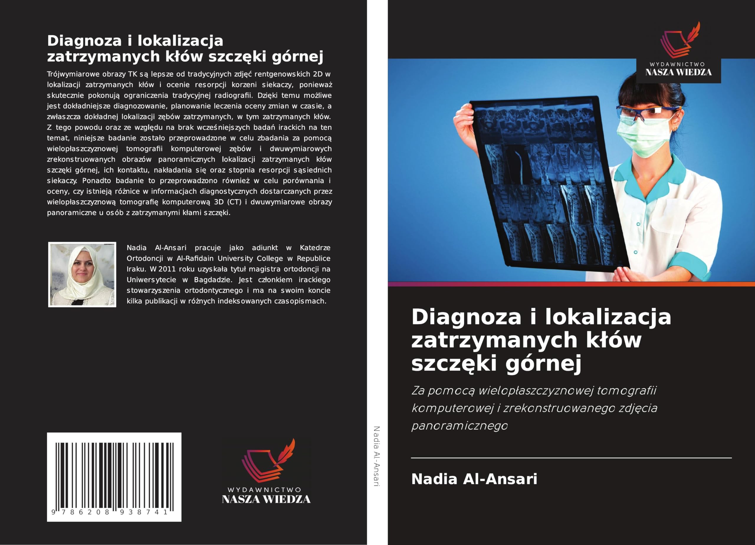 Diagnoza i lokalizacja zatrzymanych k¿ów szcz¿ki górnej Medicine