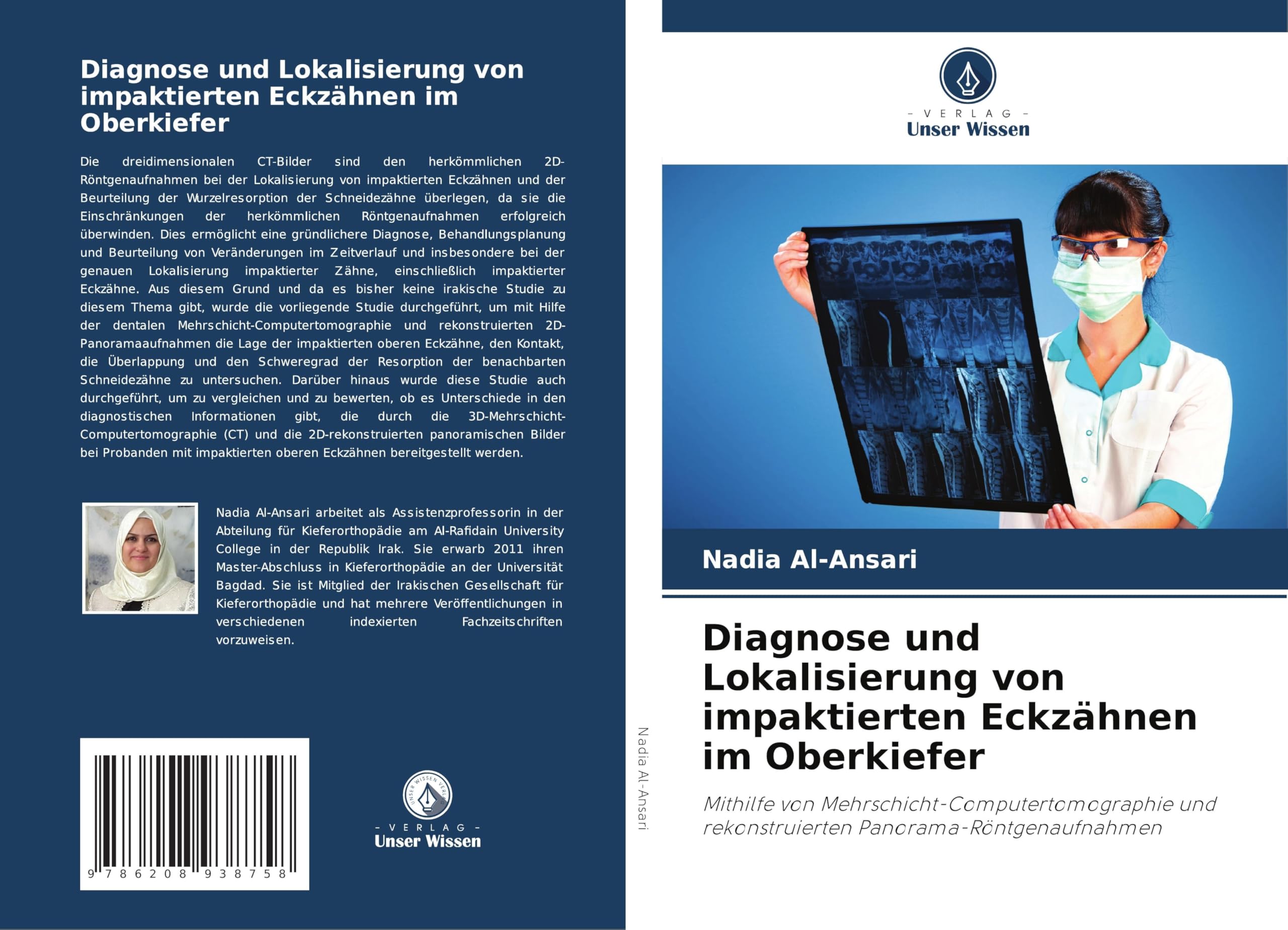 Diagnose und Lokalisierung von impaktierten Eckzähnen im Oberkiefer Medicine