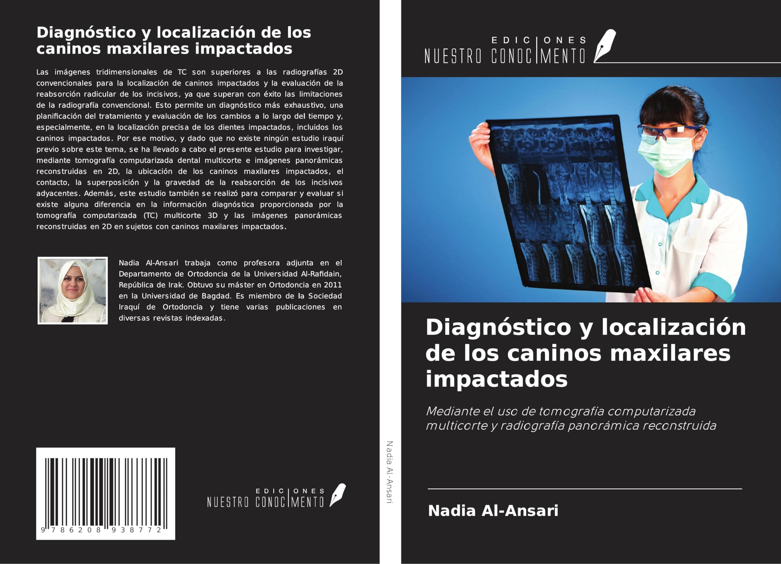 Diagnóstico y localización de los caninos maxilares impactados Medicine