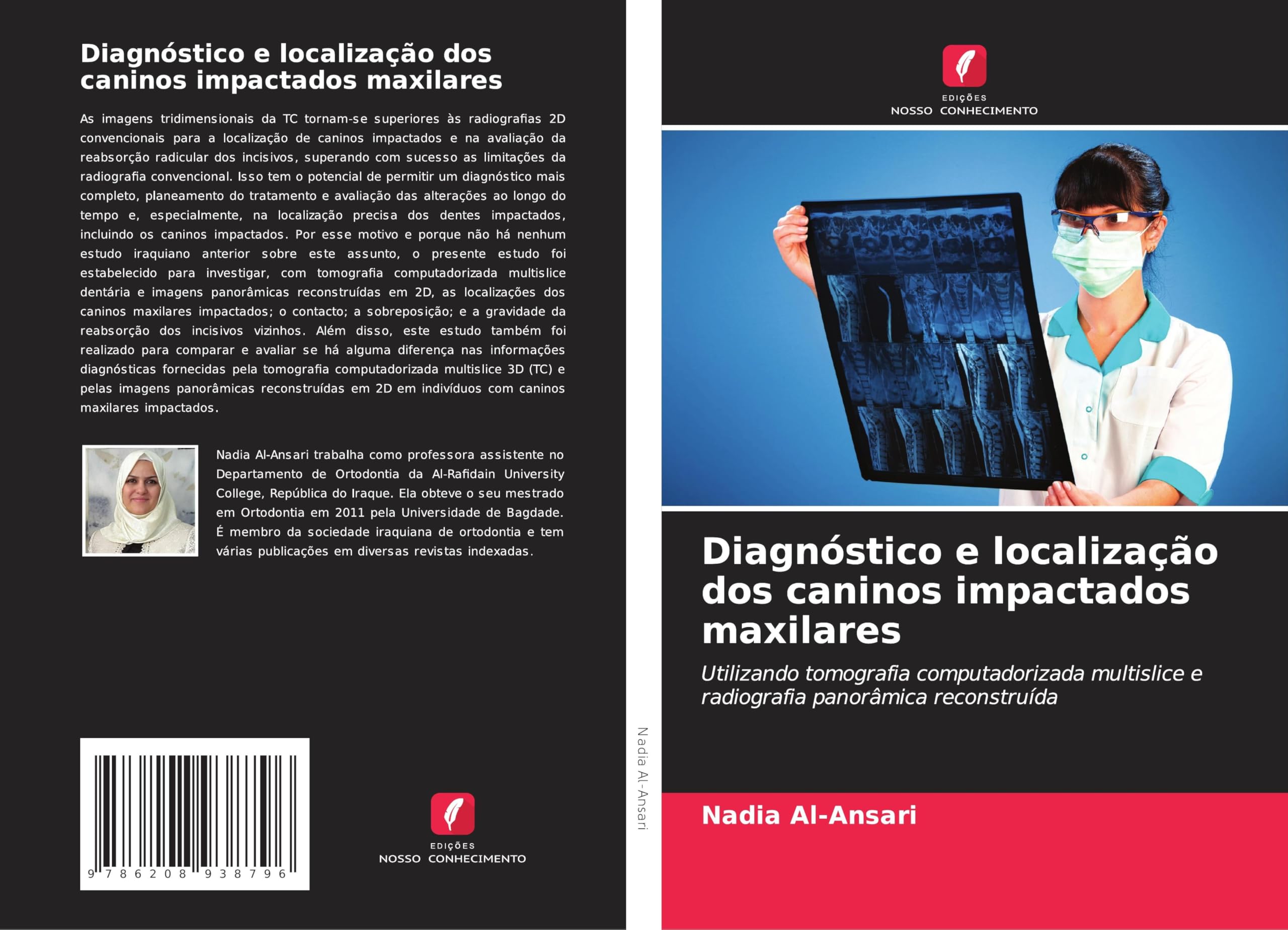 Diagnóstico e localização dos caninos impactados maxilares Medicine