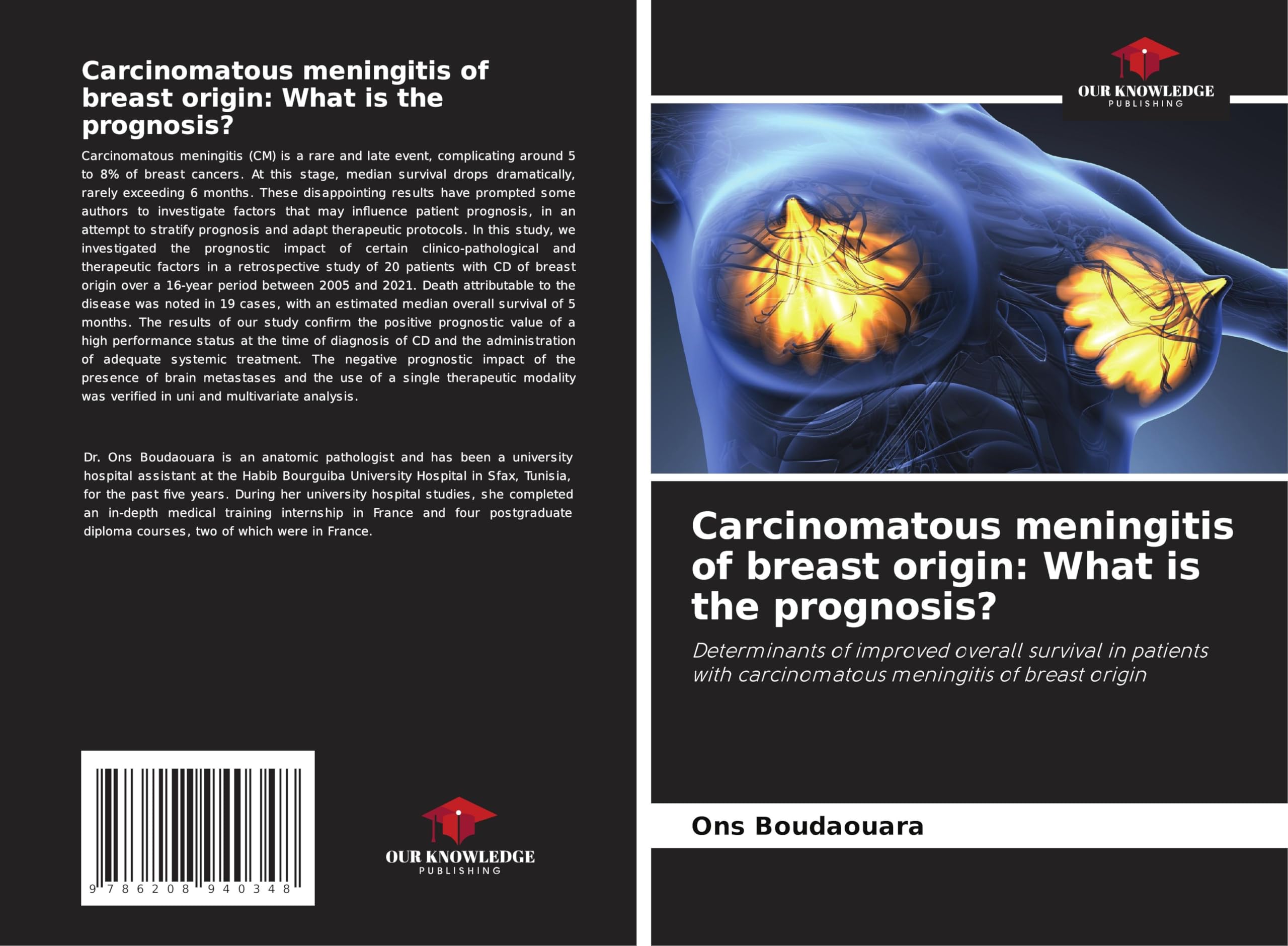Carcinomatous meningitis of breast origin: What is the prognosis? Medicine