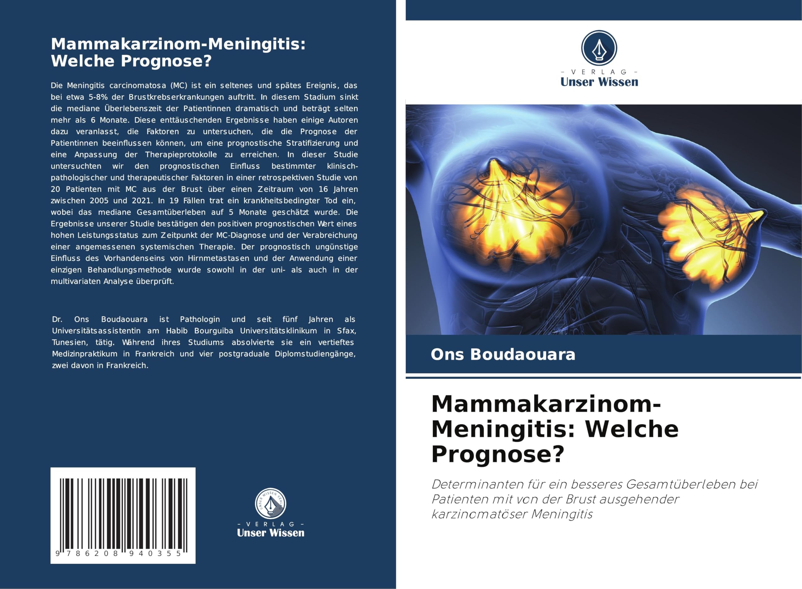 Mammakarzinom-Meningitis: Welche Prognose? Medicine