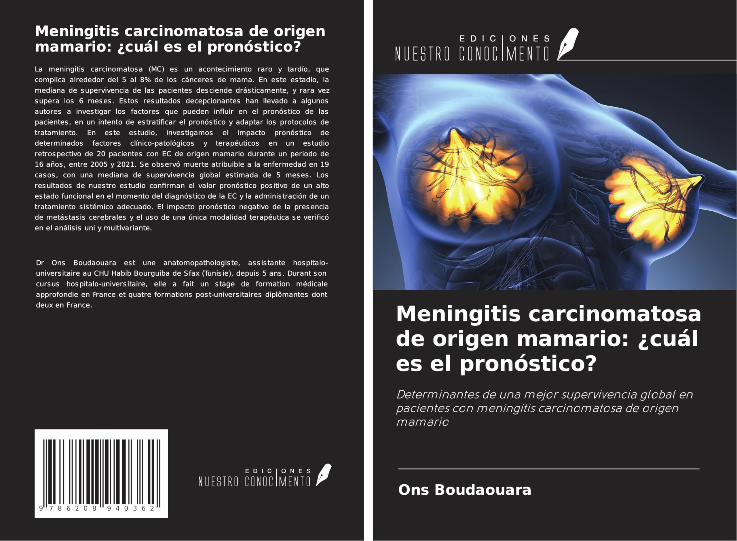 Meningitis carcinomatosa de origen mamario: ¿cuál es el pronóstico? Medicine