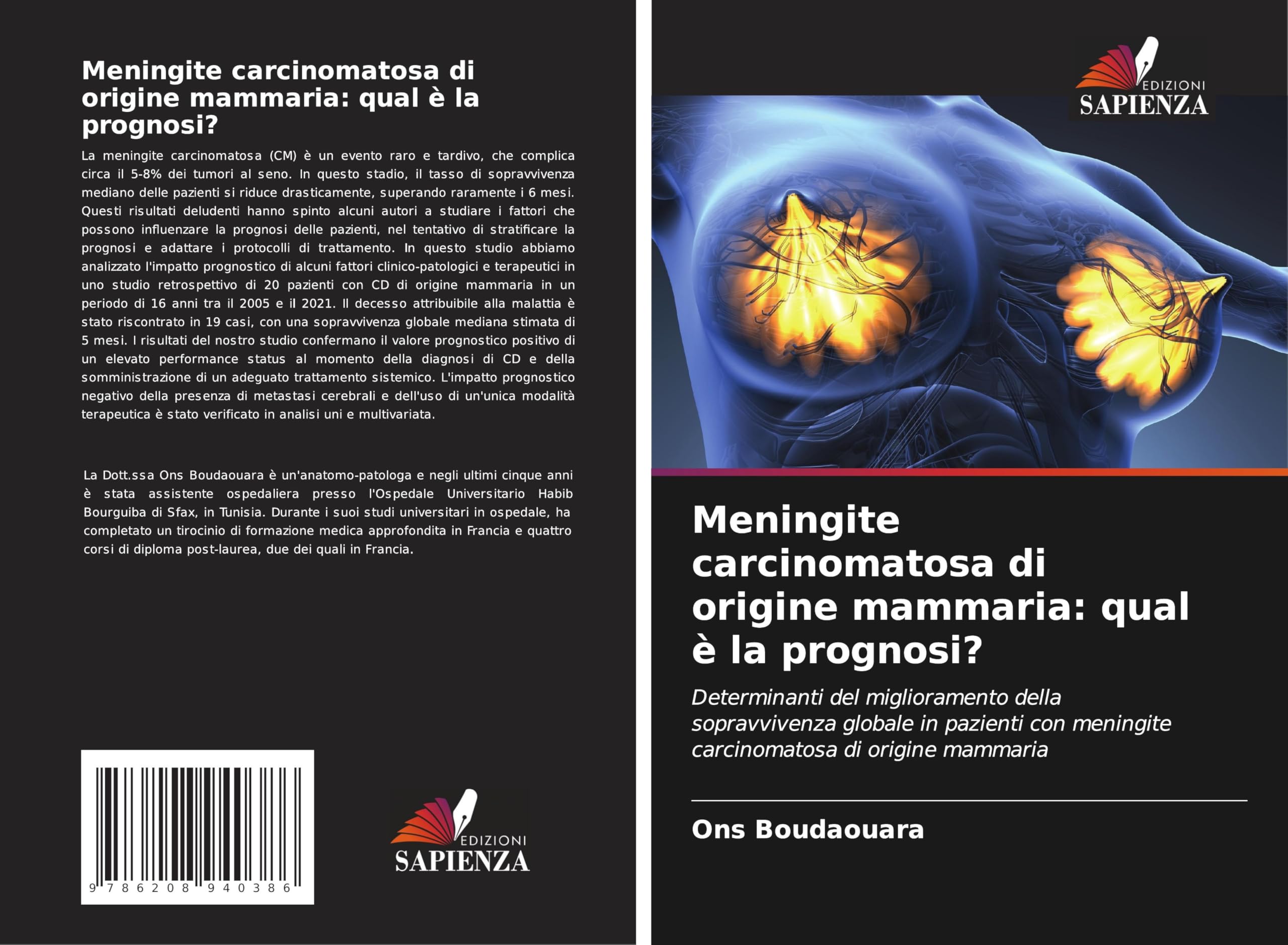 Meningite carcinomatosa di origine mammaria: qual è la prognosi? Medicine