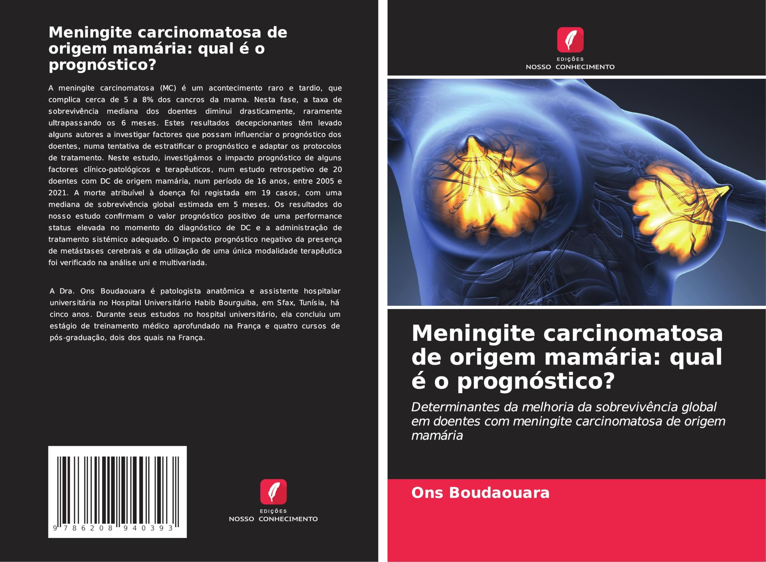 Meningite carcinomatosa de origem mamária: qual é o prognóstico? Medicine
