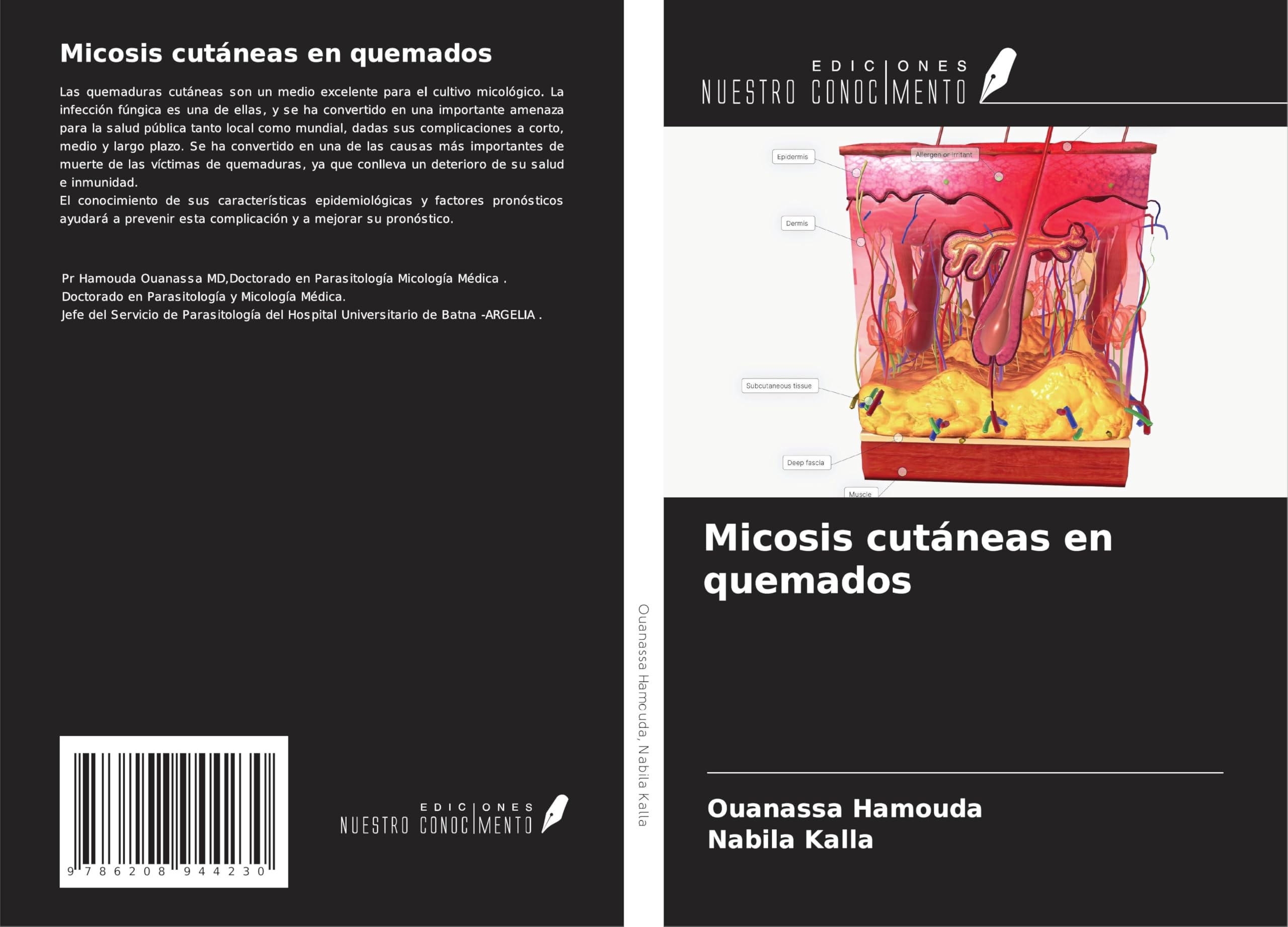 Micosis cutáneas en quemados Medicine