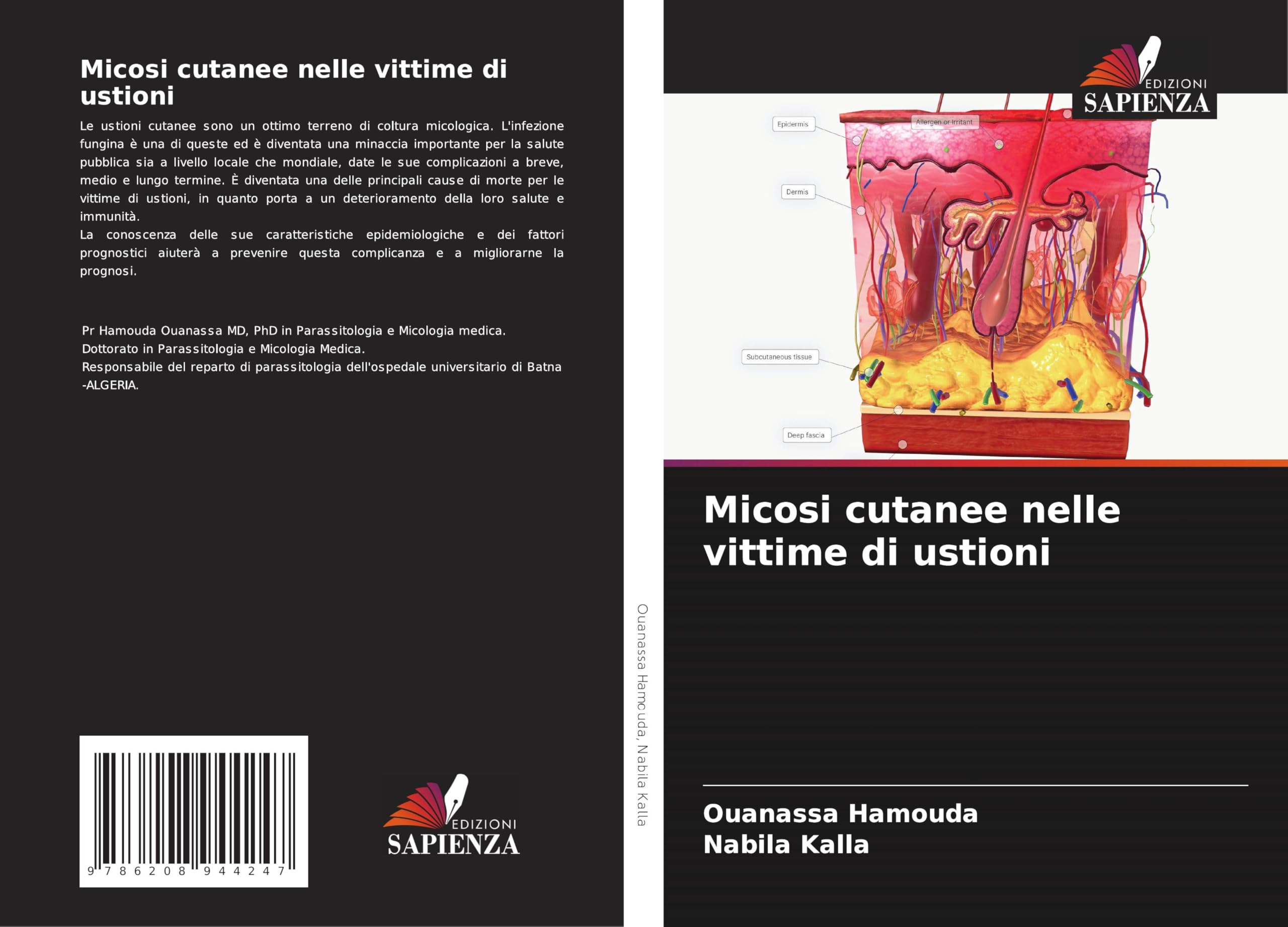 Micosi cutanee nelle vittime di ustioni Medicine