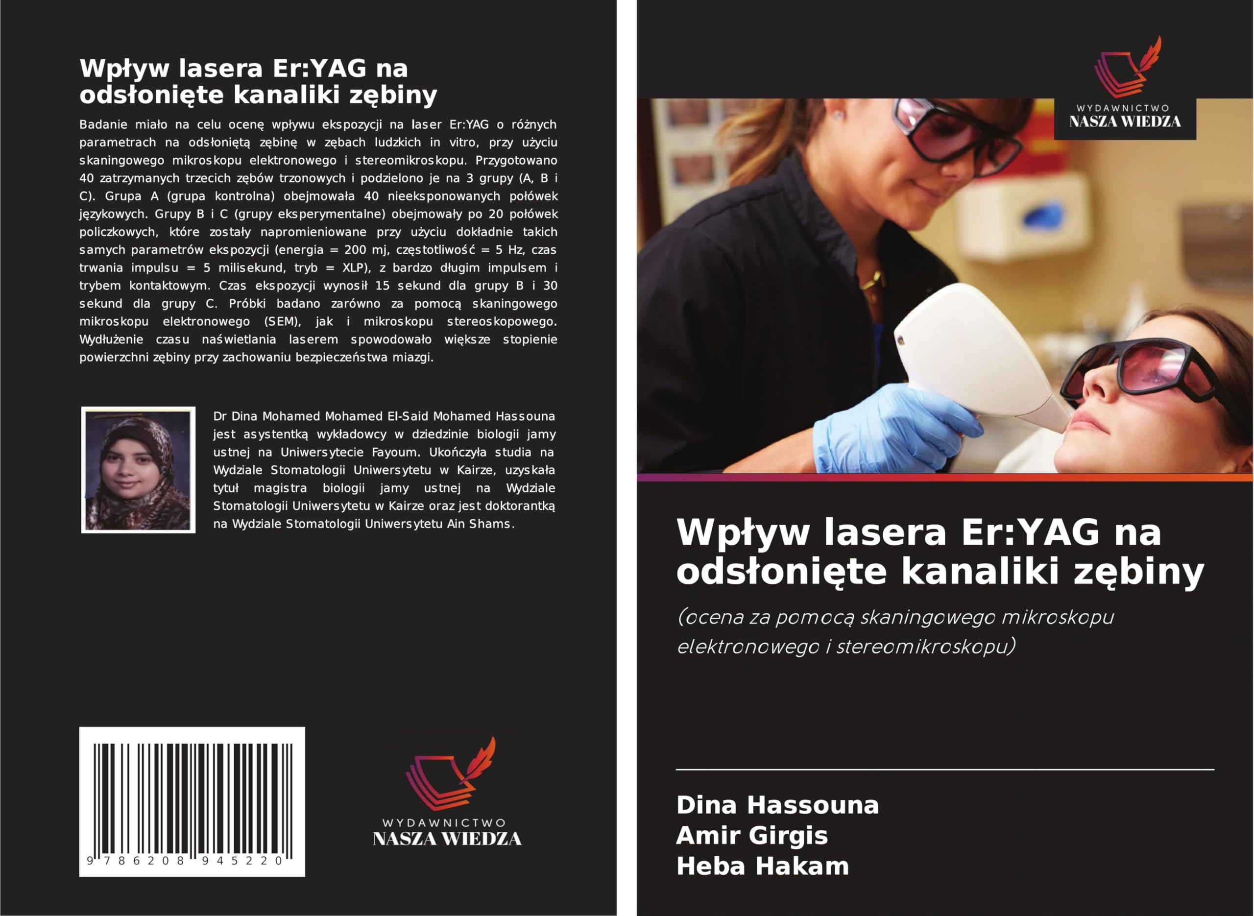 Wp¿yw lasera Er:YAG na ods¿oni¿te kanaliki z¿biny: (ocena za pomoc¿ skaningowego mikroskopu elektronowego i stereomikroskopu) Medicine