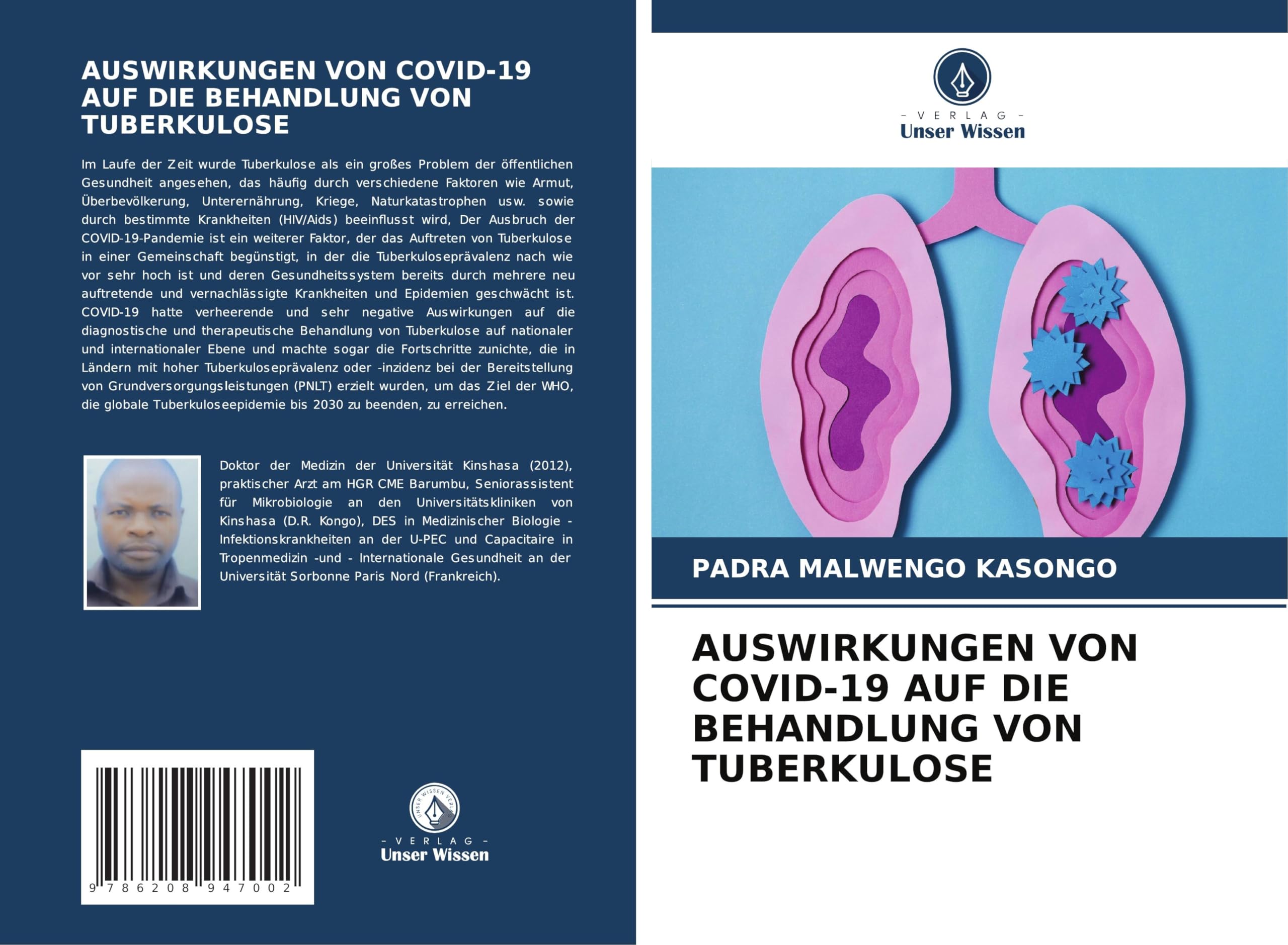 AUSWIRKUNGEN VON COVID-19 AUF DIE BEHANDLUNG VON TUBERKULOSE Medicine