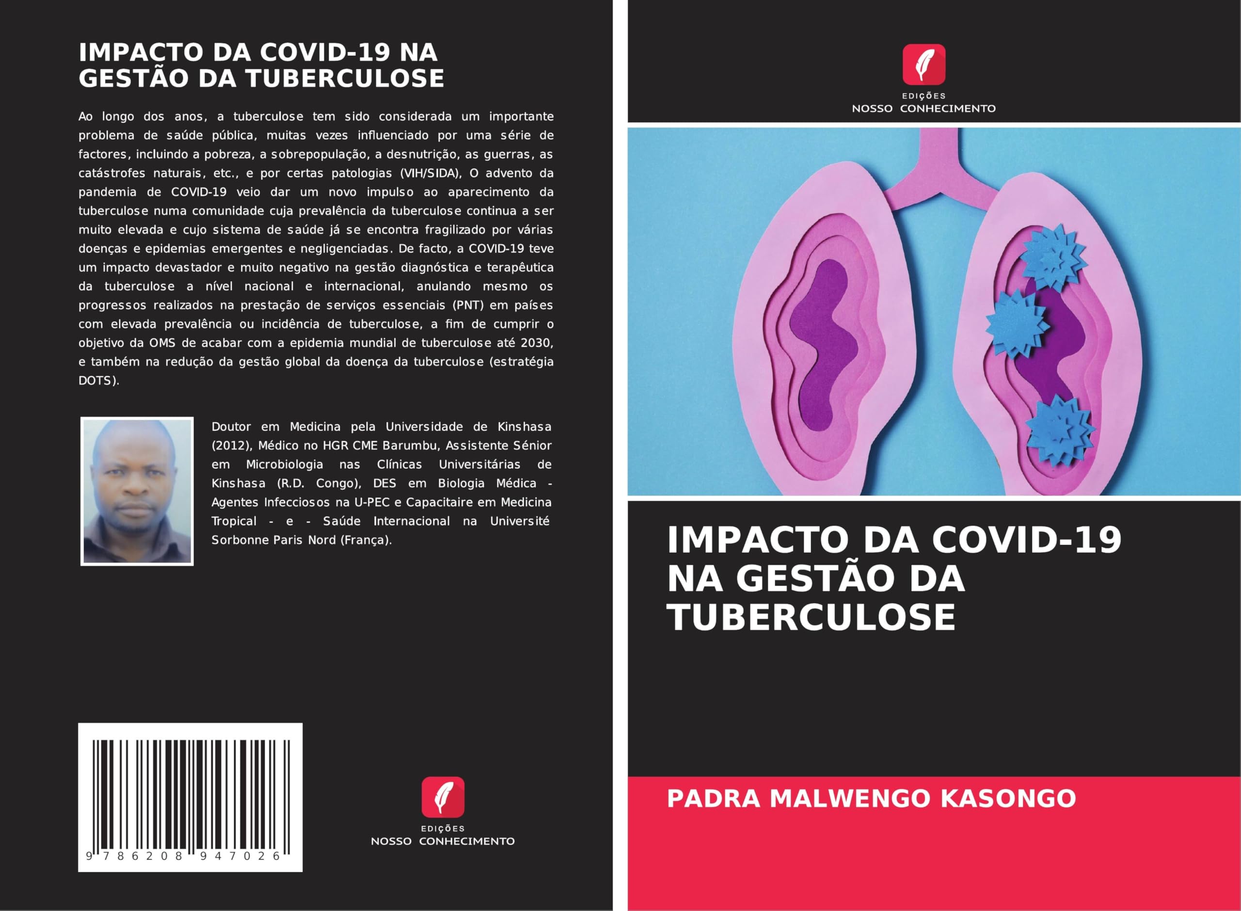 IMPACTO DA COVID-19 NA GESTÃO DA TUBERCULOSE Medicine
