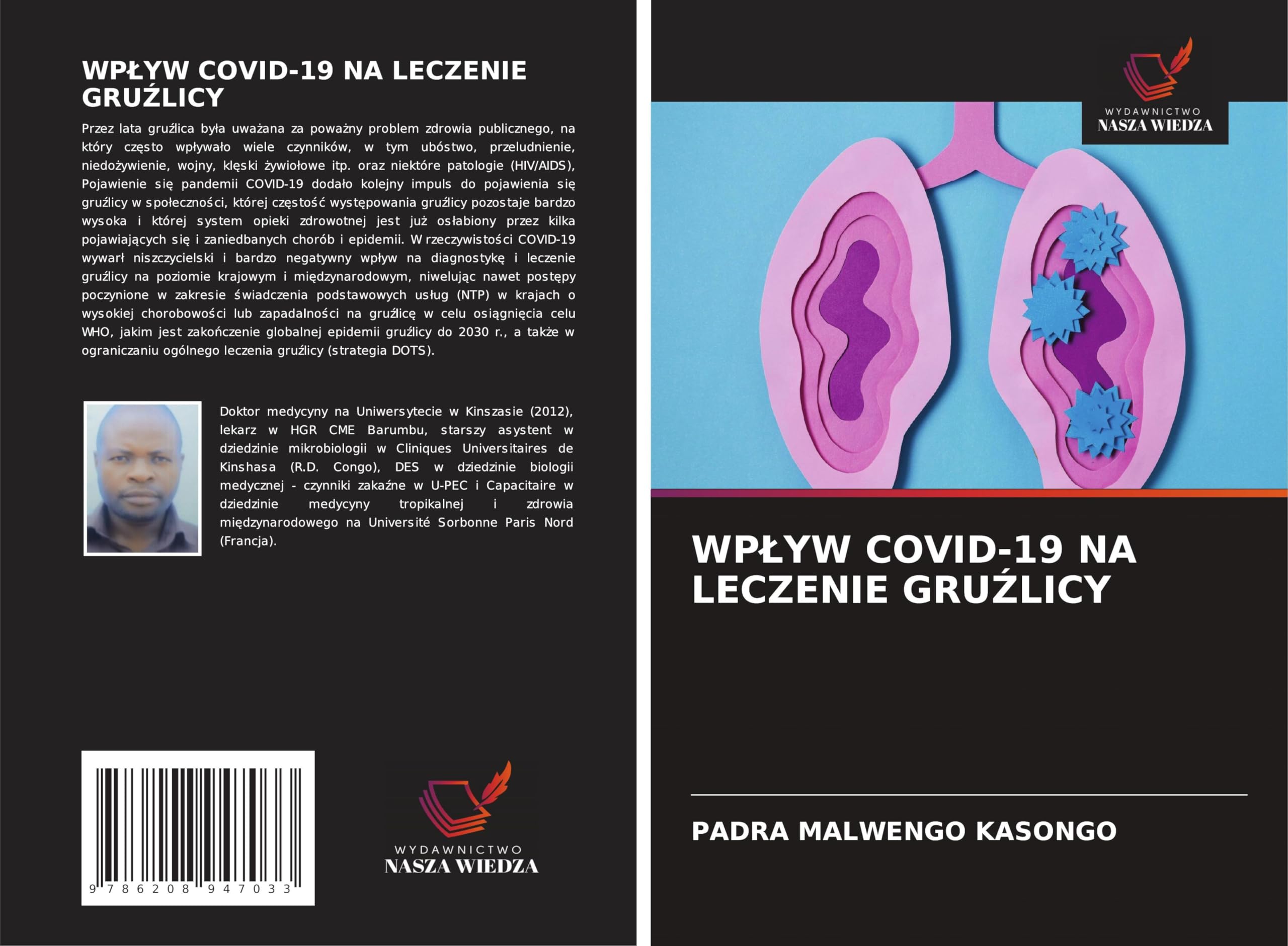WP¿YW COVID-19 NA LECZENIE GRU¿LICY Medicine