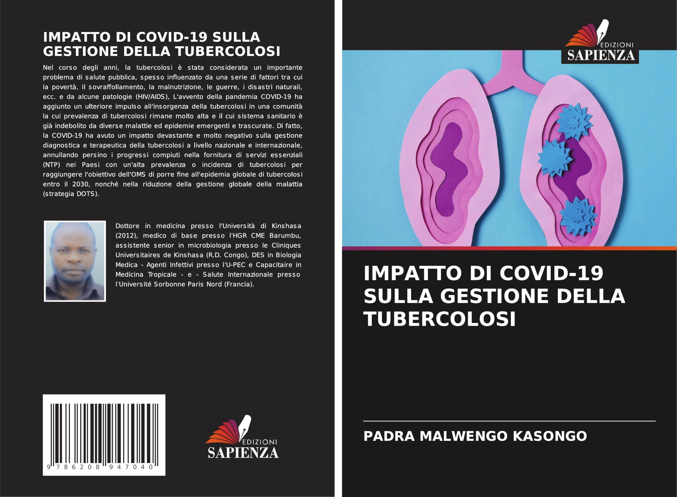 IMPATTO DI COVID-19 SULLA GESTIONE DELLA TUBERCOLOSI Medicine